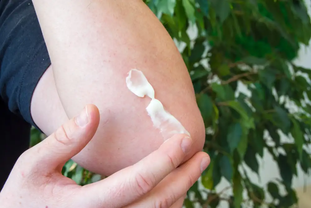 Atopic dermatitis