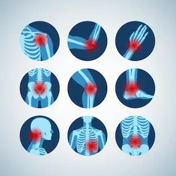 Chronic pain