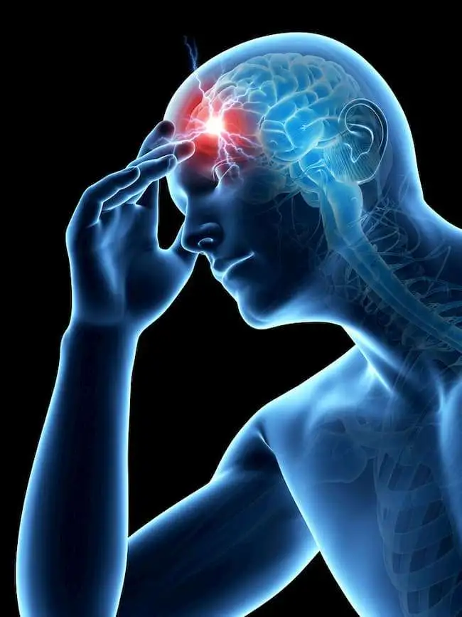 Испытана новая терапия кластерной головной боли