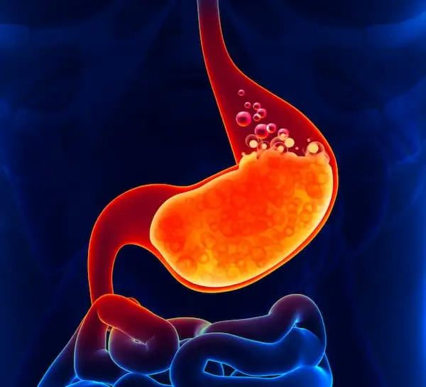 Reflux disease
