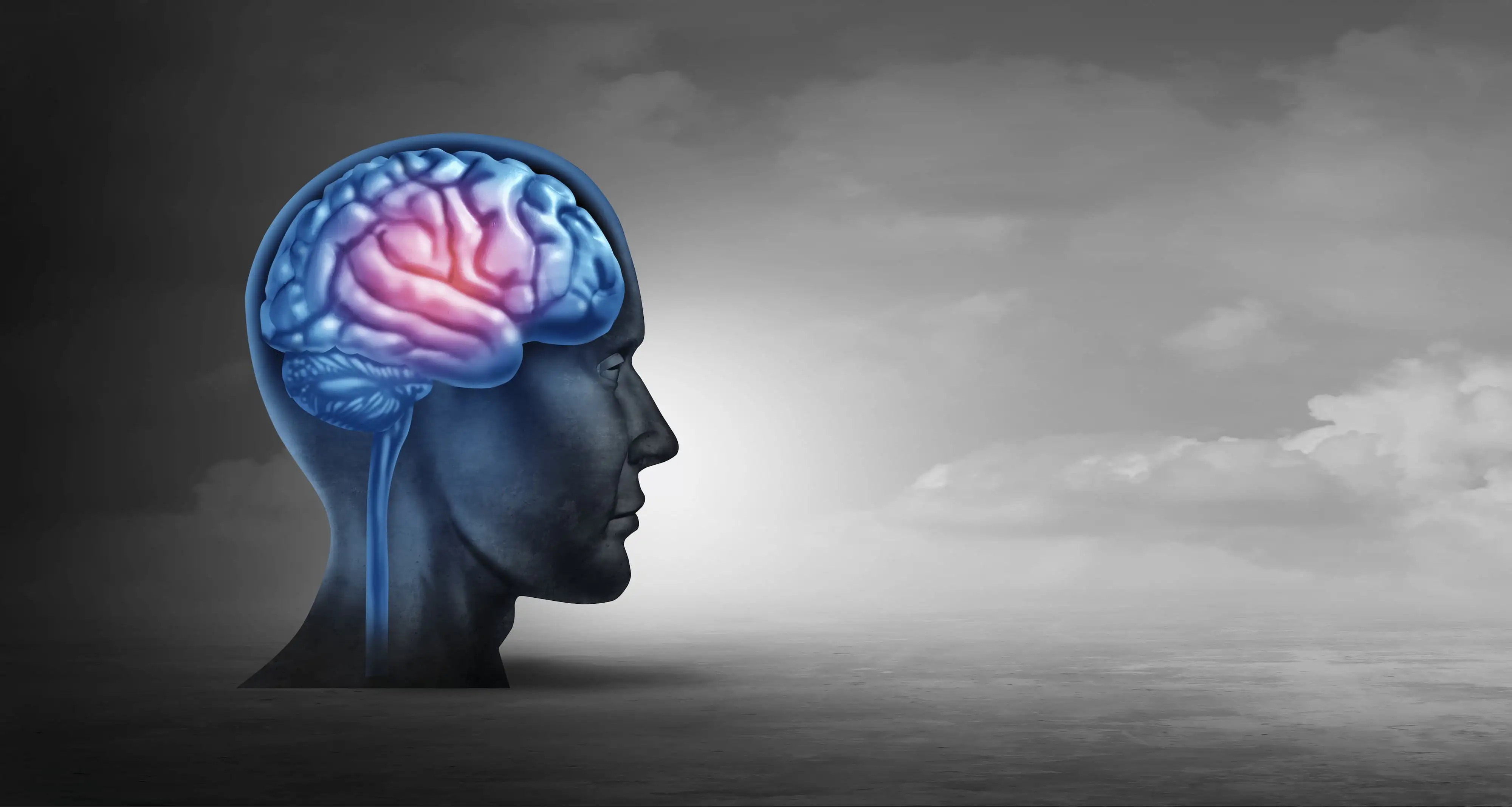 Cerebral venous thrombosis