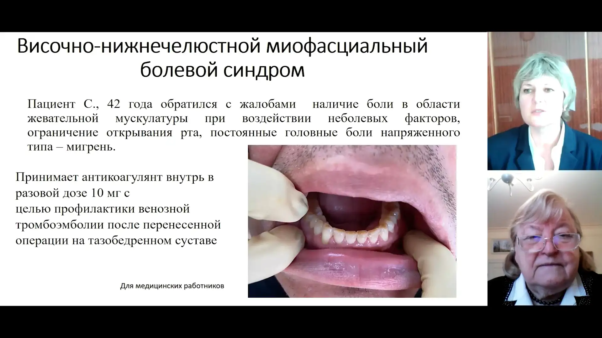 Македонова Ю.А., Яковенко Э.П. Височно-нижнечелюстной миофасциальный болевой синдром
