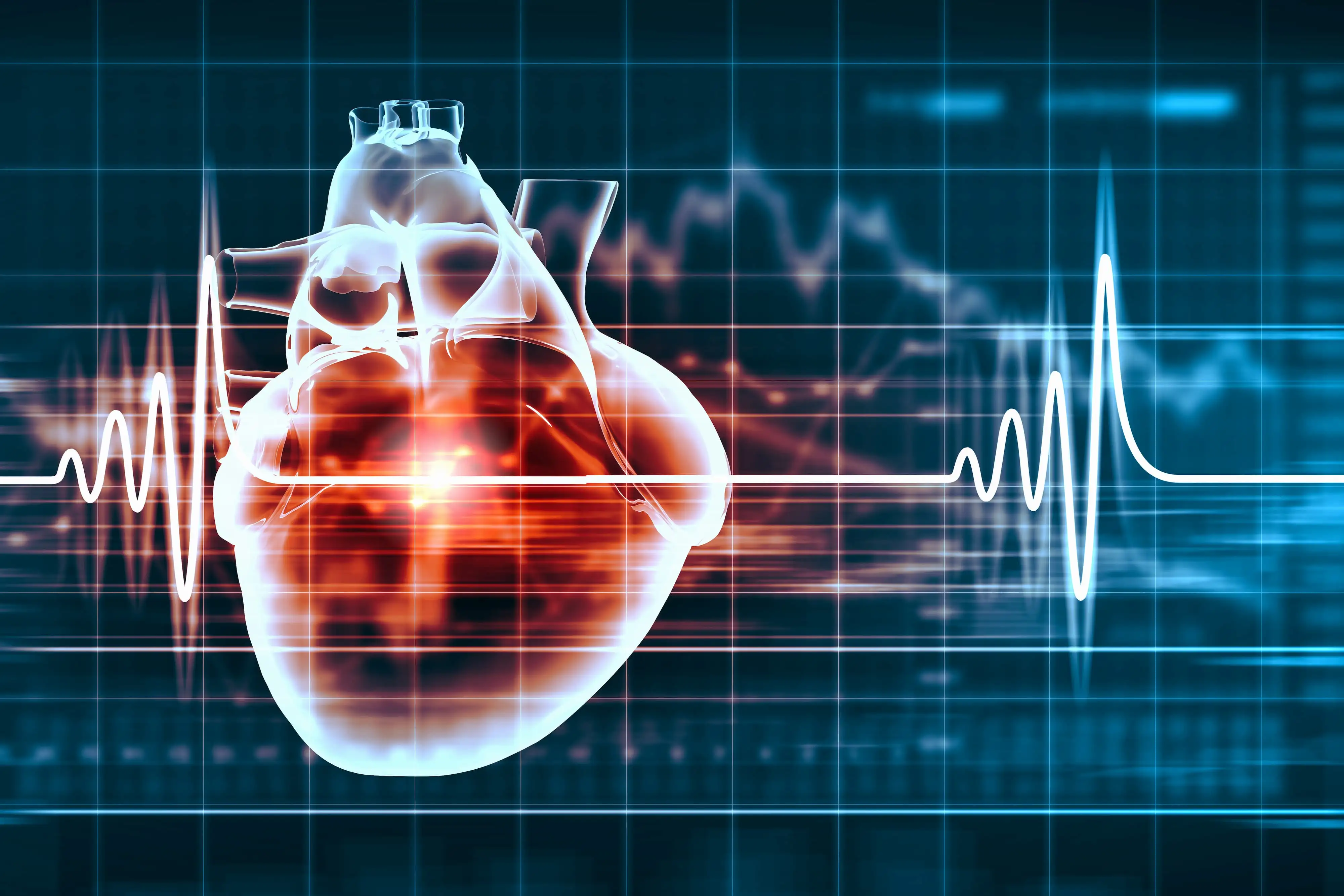 Supraventricular tachyarrhythmia