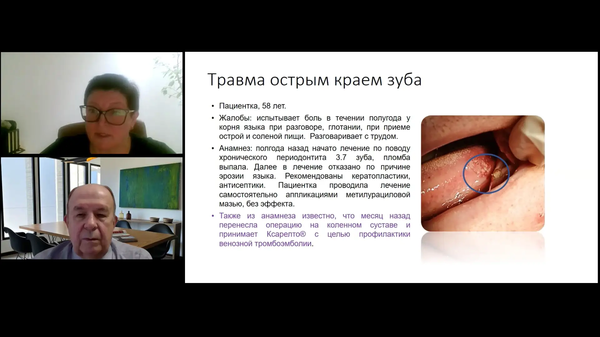 Лучшева Л.Ф., Алексеенко С.А. Травма языка, случай 3