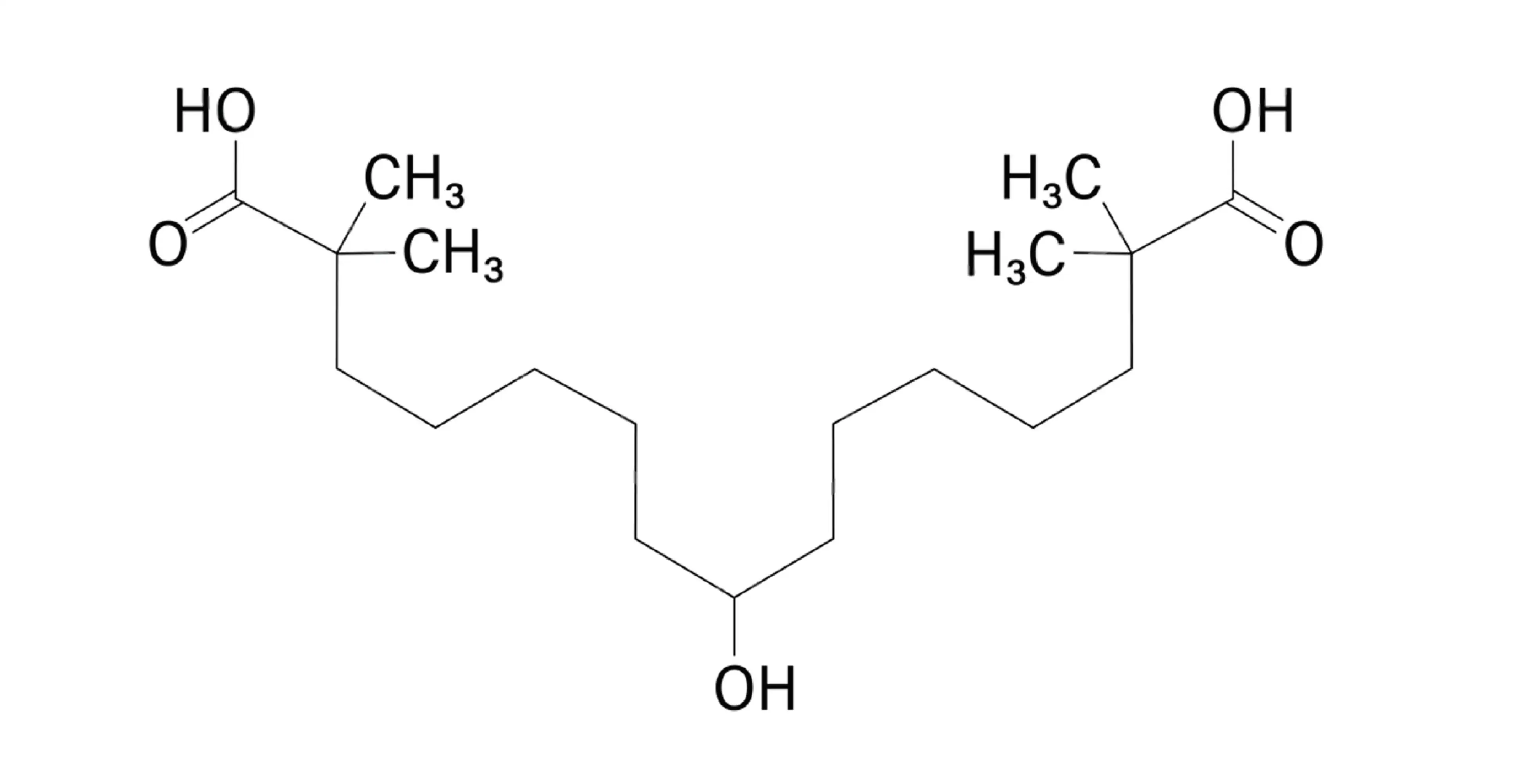Heterozygous familial hypercholesterolemia