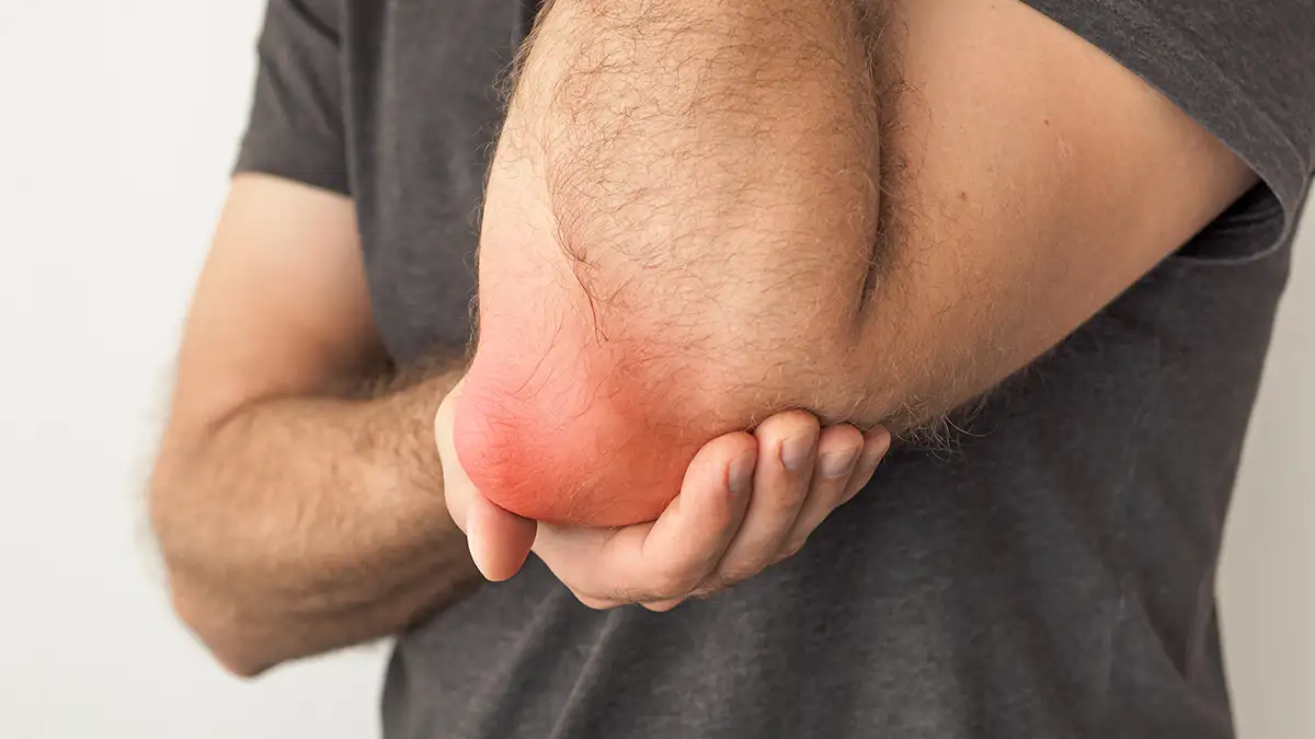 Бурситы как отражение системной ревматической патологии