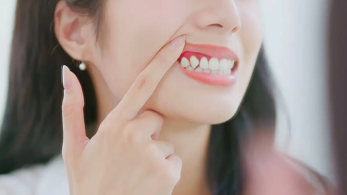 Использование лазера в пародонтологии