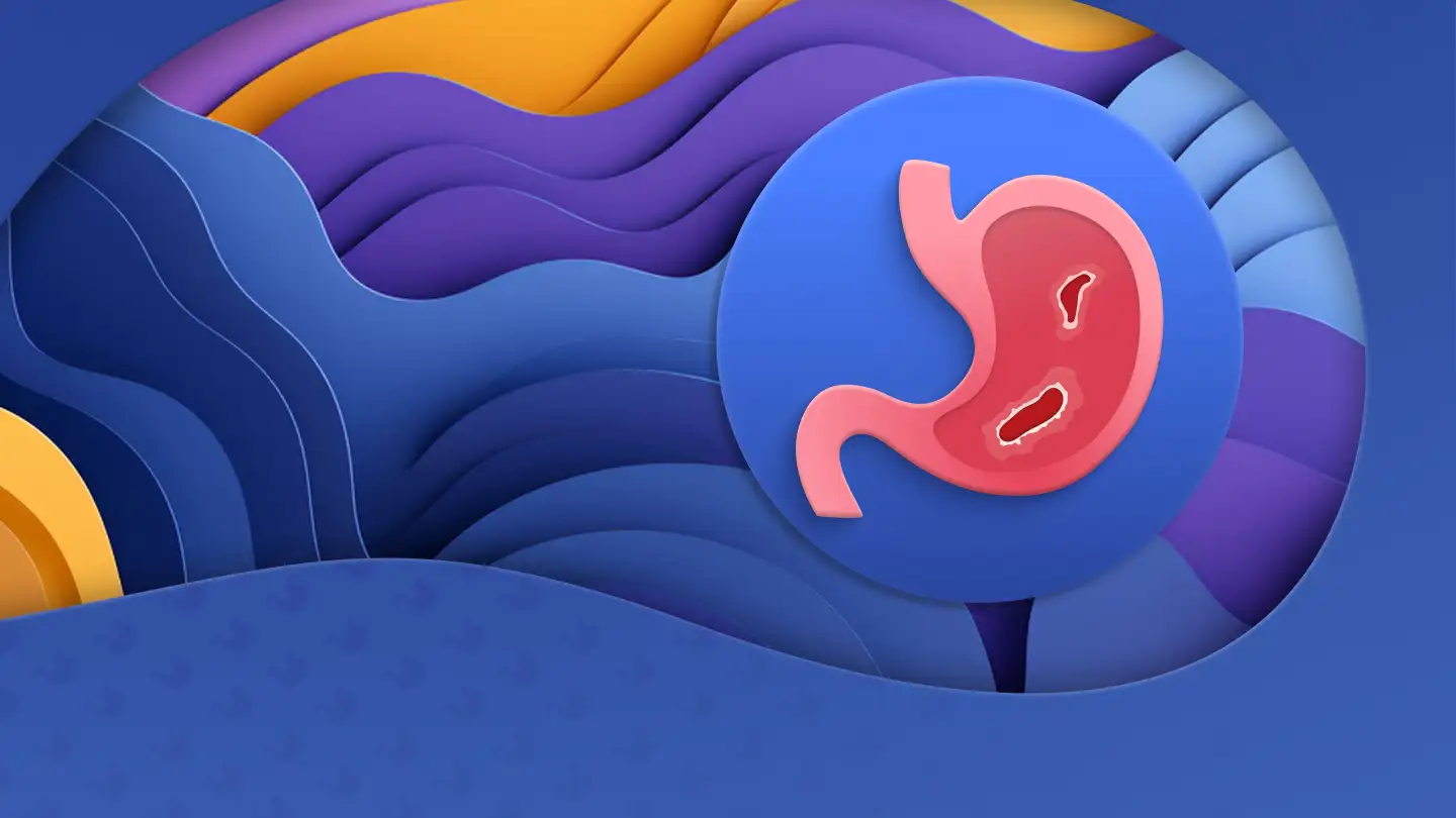 Клинические рекомендации по лечению язвенной болезни (2024 год)