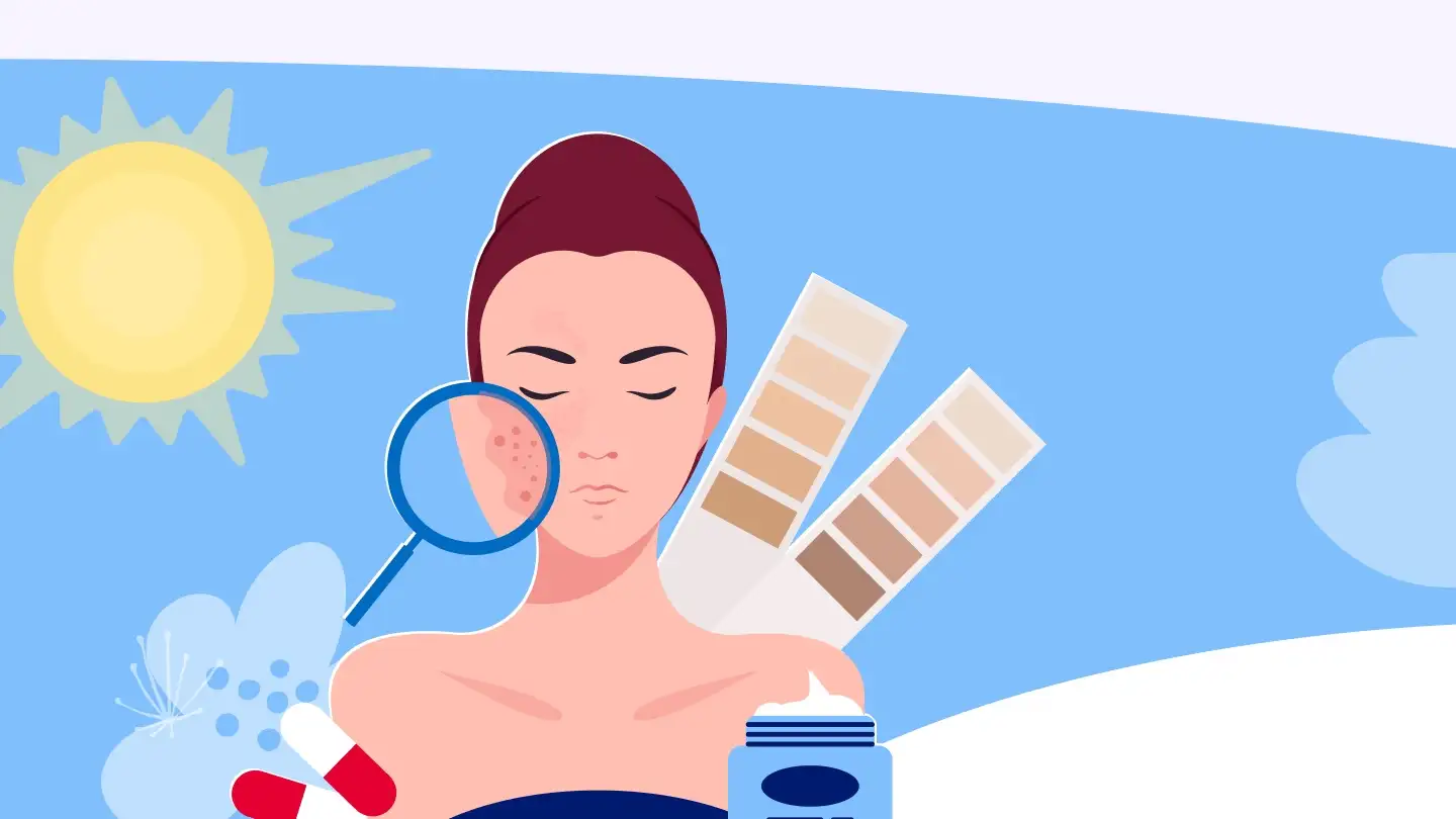 Фотоиндуцированные кожные реакции