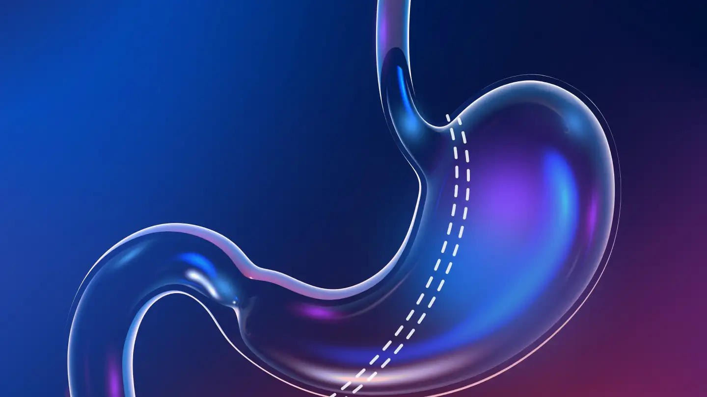 После бариатрической хирургии: как снизить риск осложнений