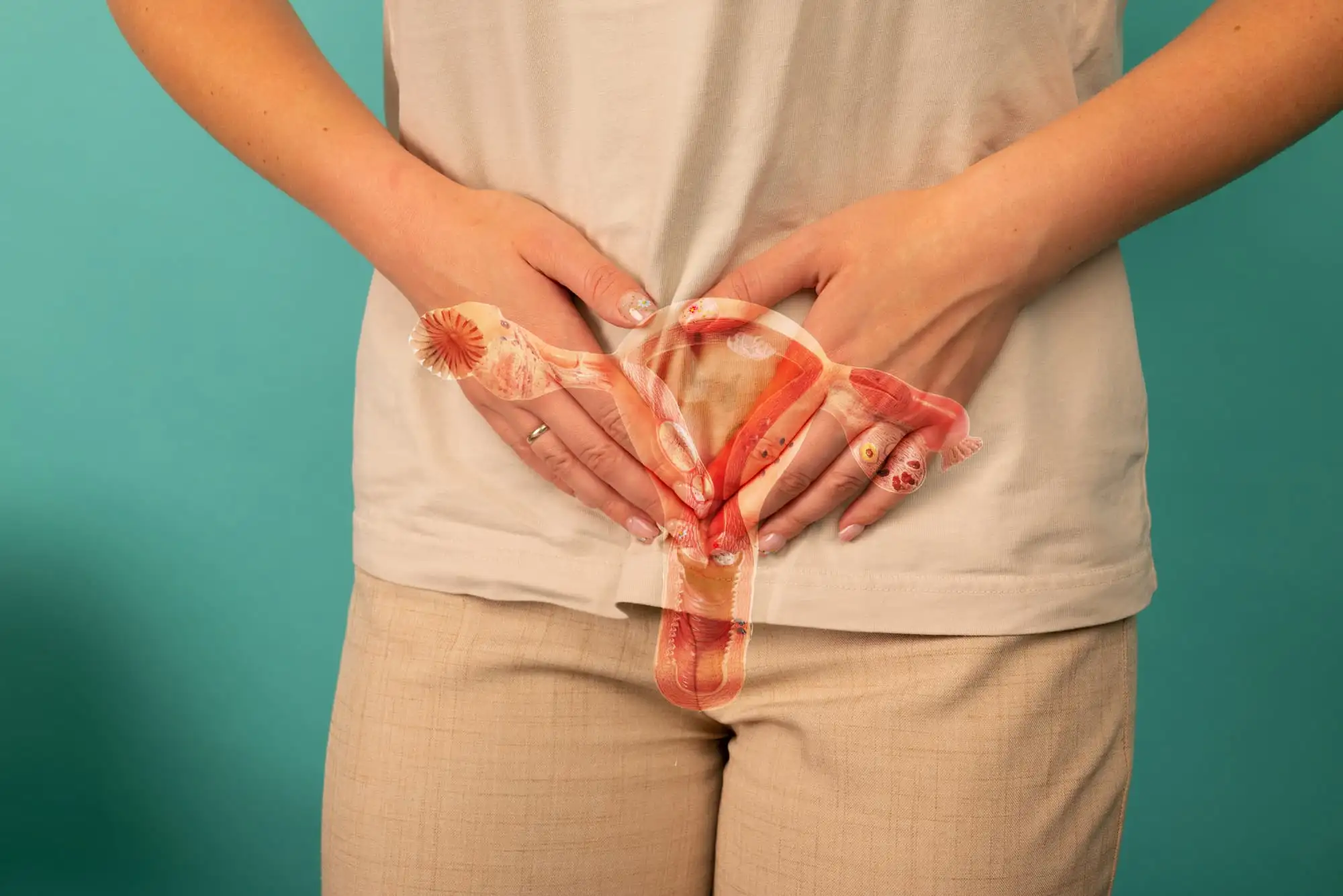 Бактериальный вагиноз