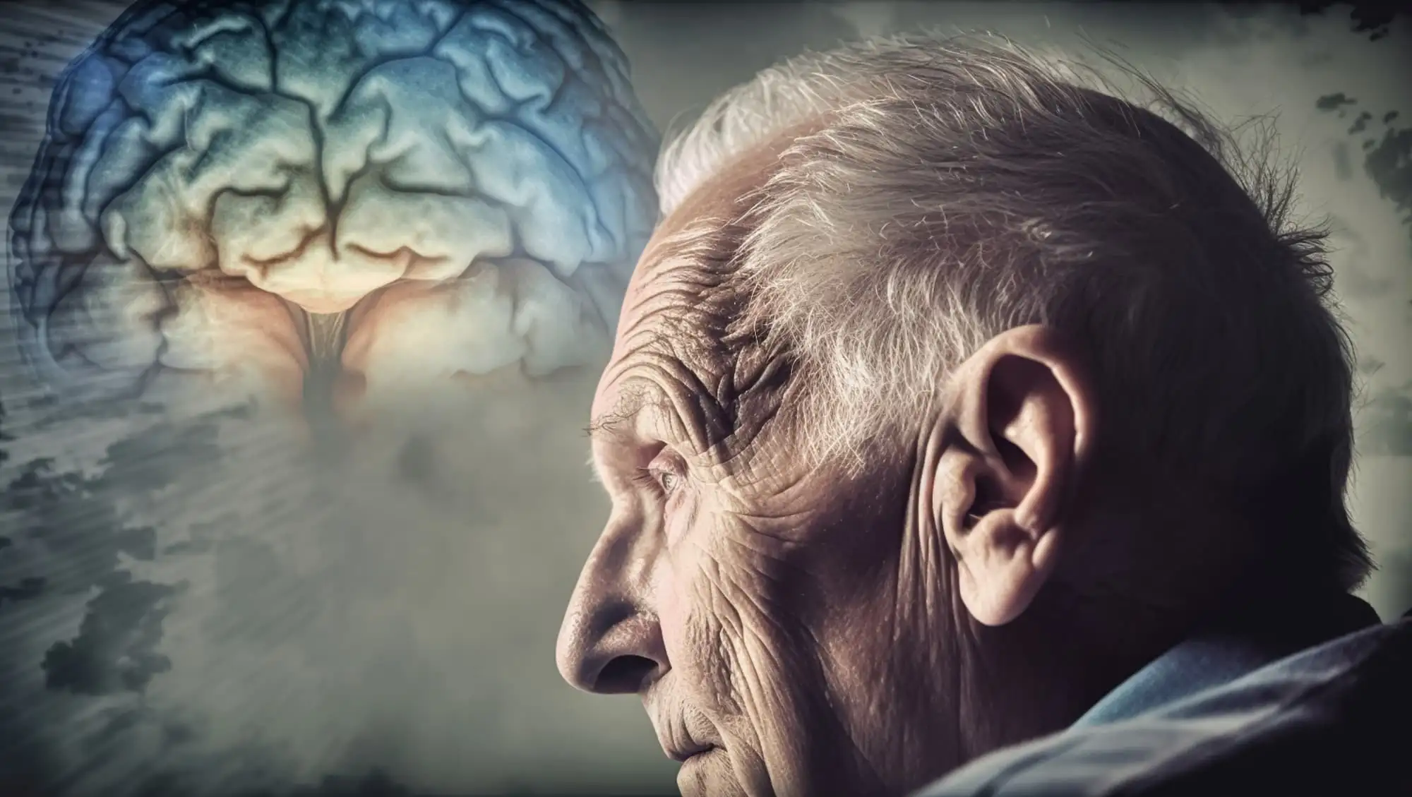 Alzheimer disease