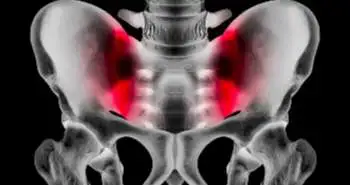 Связаны ли минеральная плотность костной ткани и наличие переломов в анамнезе с частотой развития и рентгенологической стадией остеоартроза коленных и тазобедренных суставов и суставов кисти у пожилых пациентов?