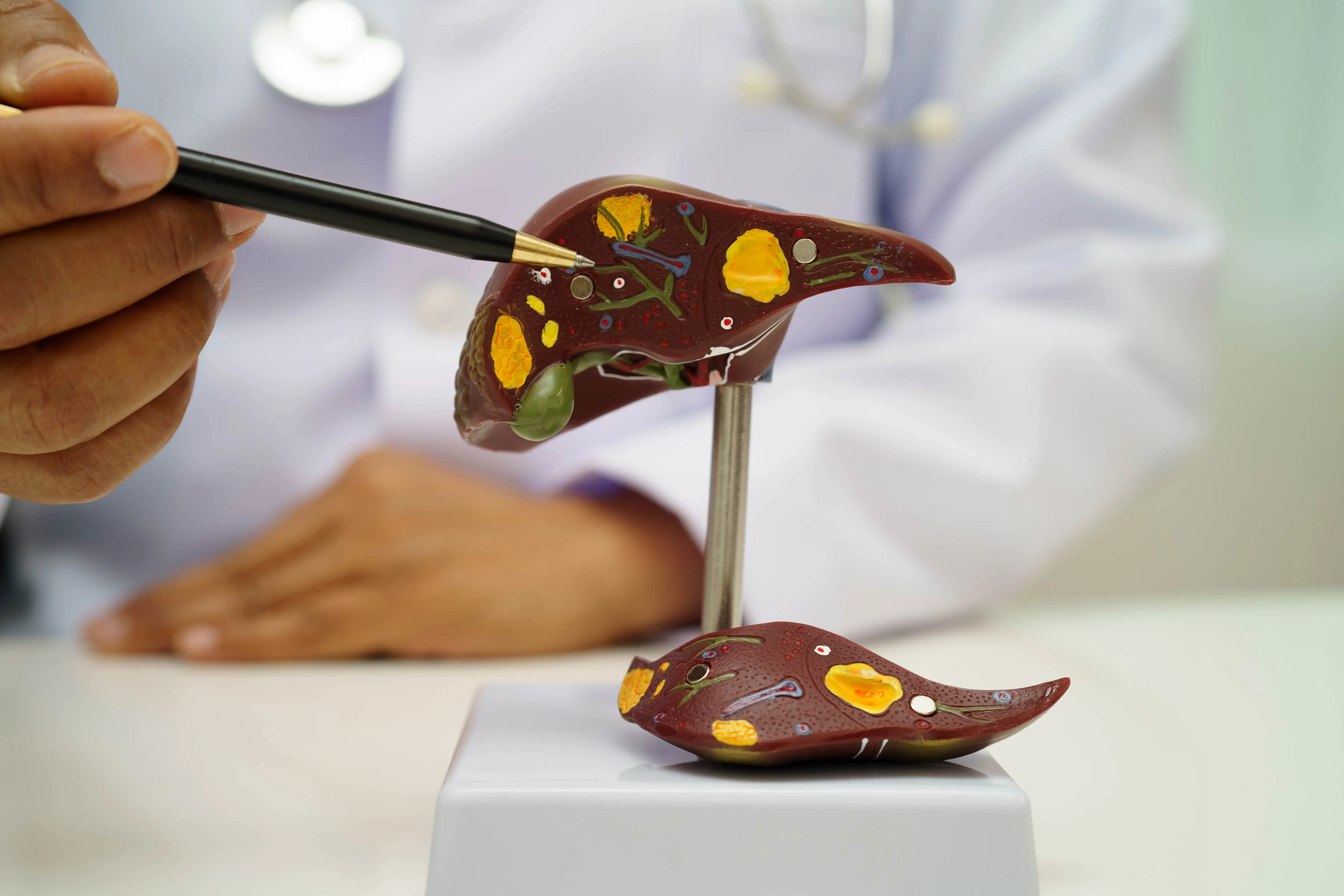 Неалкогольная жировая болезнь печени