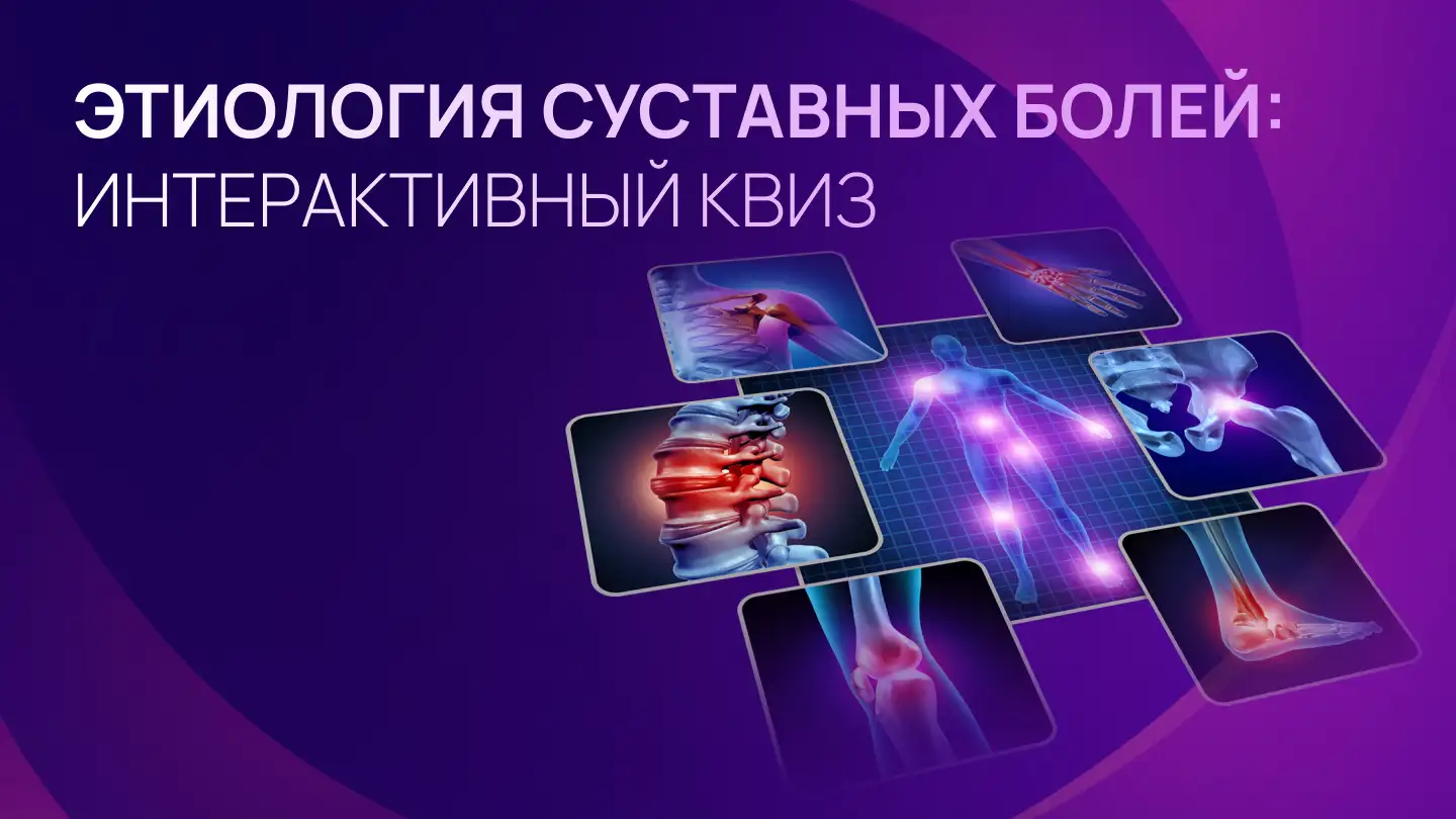 Этиология суставных болей: интерактивный квиз