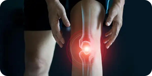 Рациональный выбор НПВП при остеоартрите у коморбидного пациента: результаты исследования НОРМА