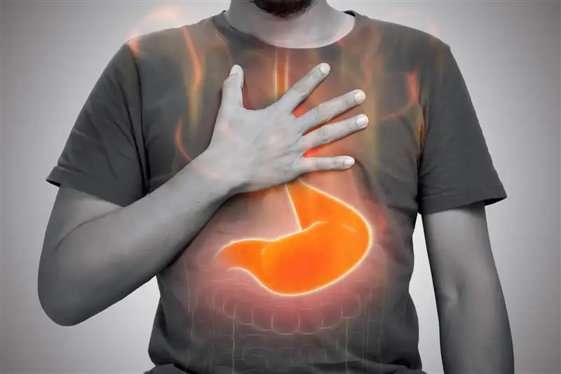 Gastroesophageal reflux disease