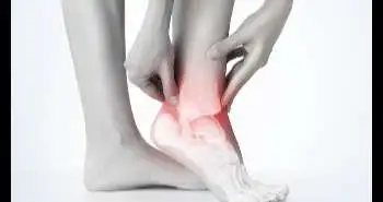 Ортопедические стельки способствуют снижению интенсивности боли у пациентов с односторонним подошвенным фасциитом