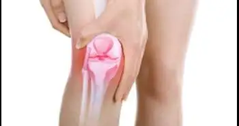 В исследовании выявлена устойчивая взаимосвязь между нагрузкой на коленный сустав и болью при ходьбе у пациентов с остеоартрозом коленного сустава
