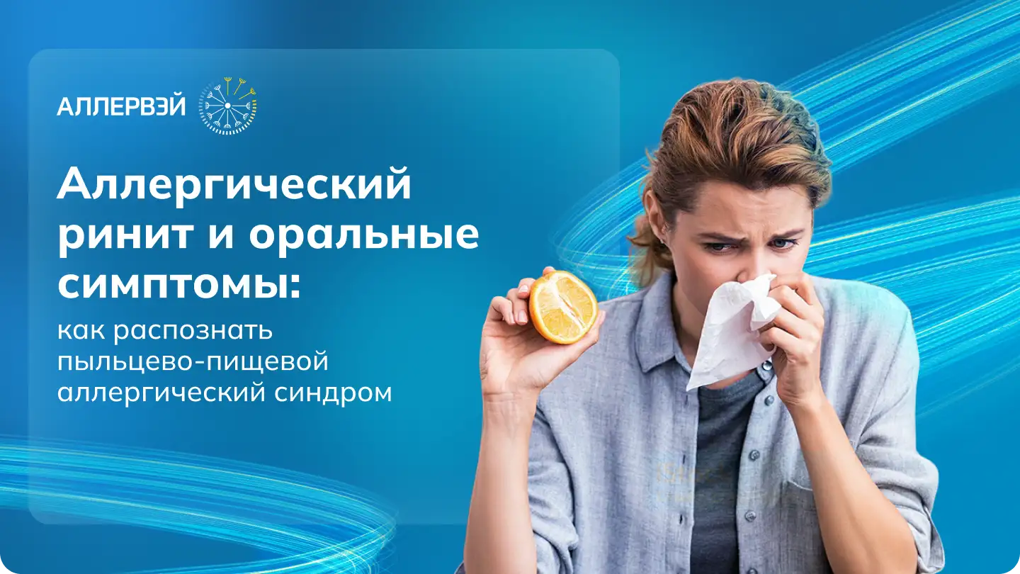 Аллергический ринит и оральные симптомы: как распознать пыльцево-пищевой аллергический синдром. Аллервэй Медзнат