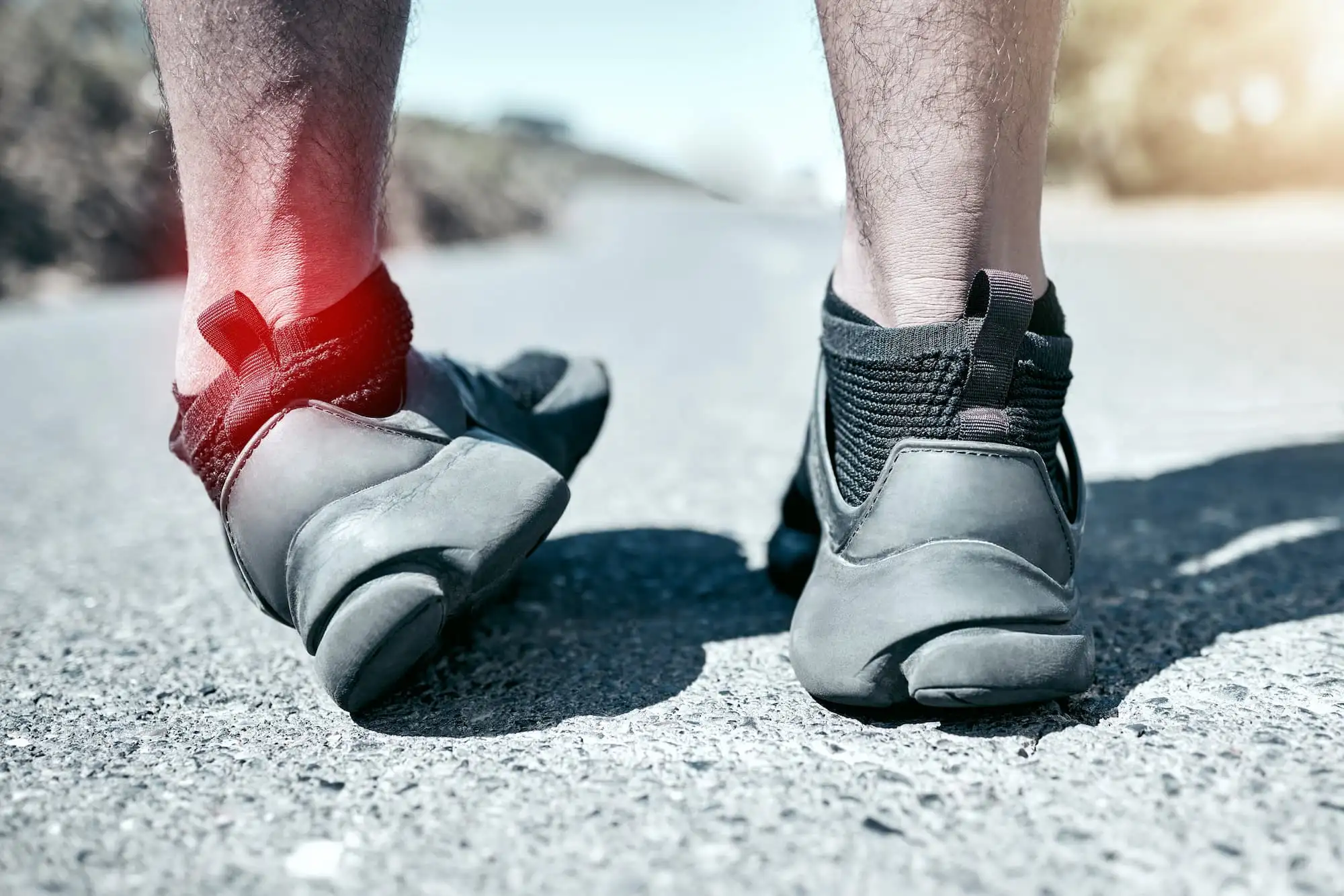 Lateral ankle sprain