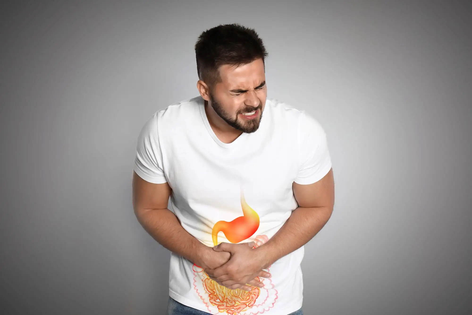 Non-constipation IBS
