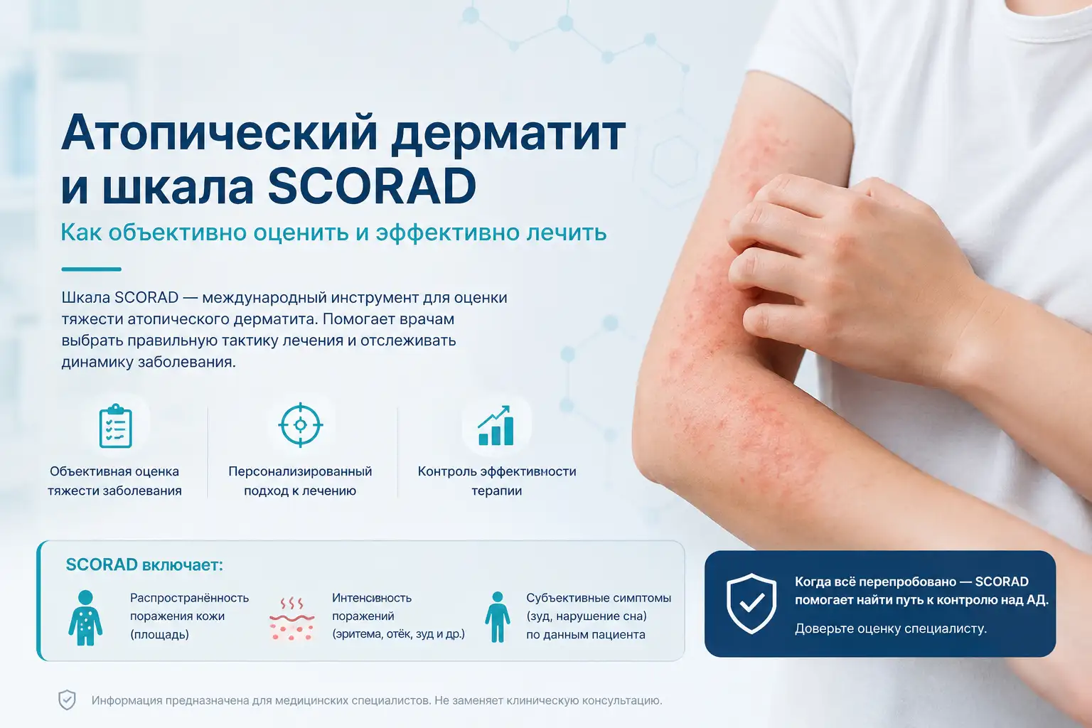 Рефрактерный атопический дерматит: клинический случай и работа со шкалой SCORAD
