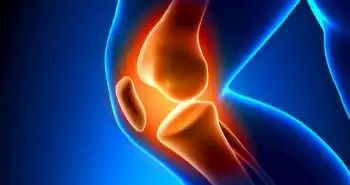 Лечение остеоартроза коленного сустава путем внутрисуставного введения обогащенной тромбоцитами плазмы, гиалуроновой кислоты и кортикостероидов