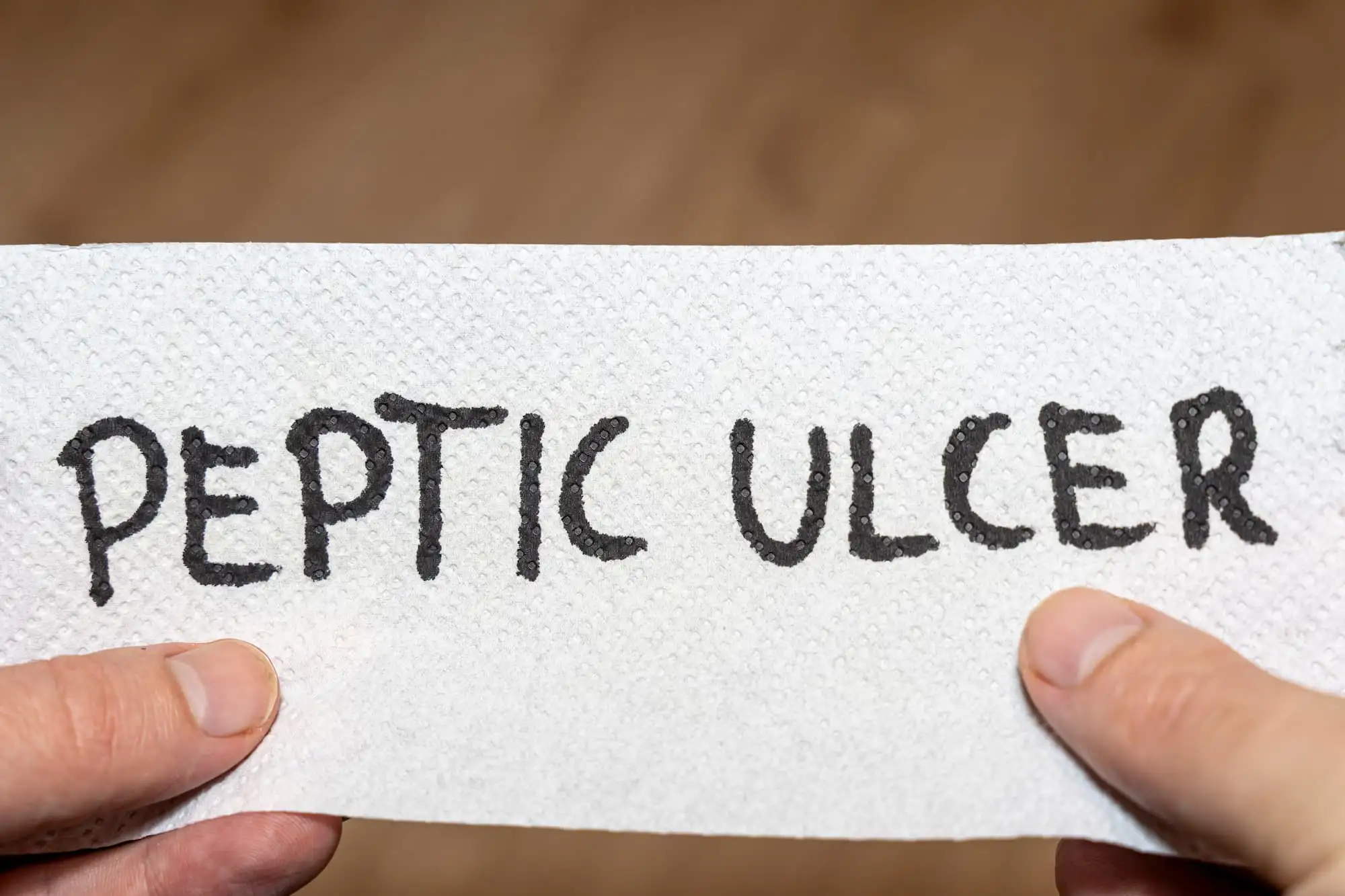 Complicated peptic ulcer disease