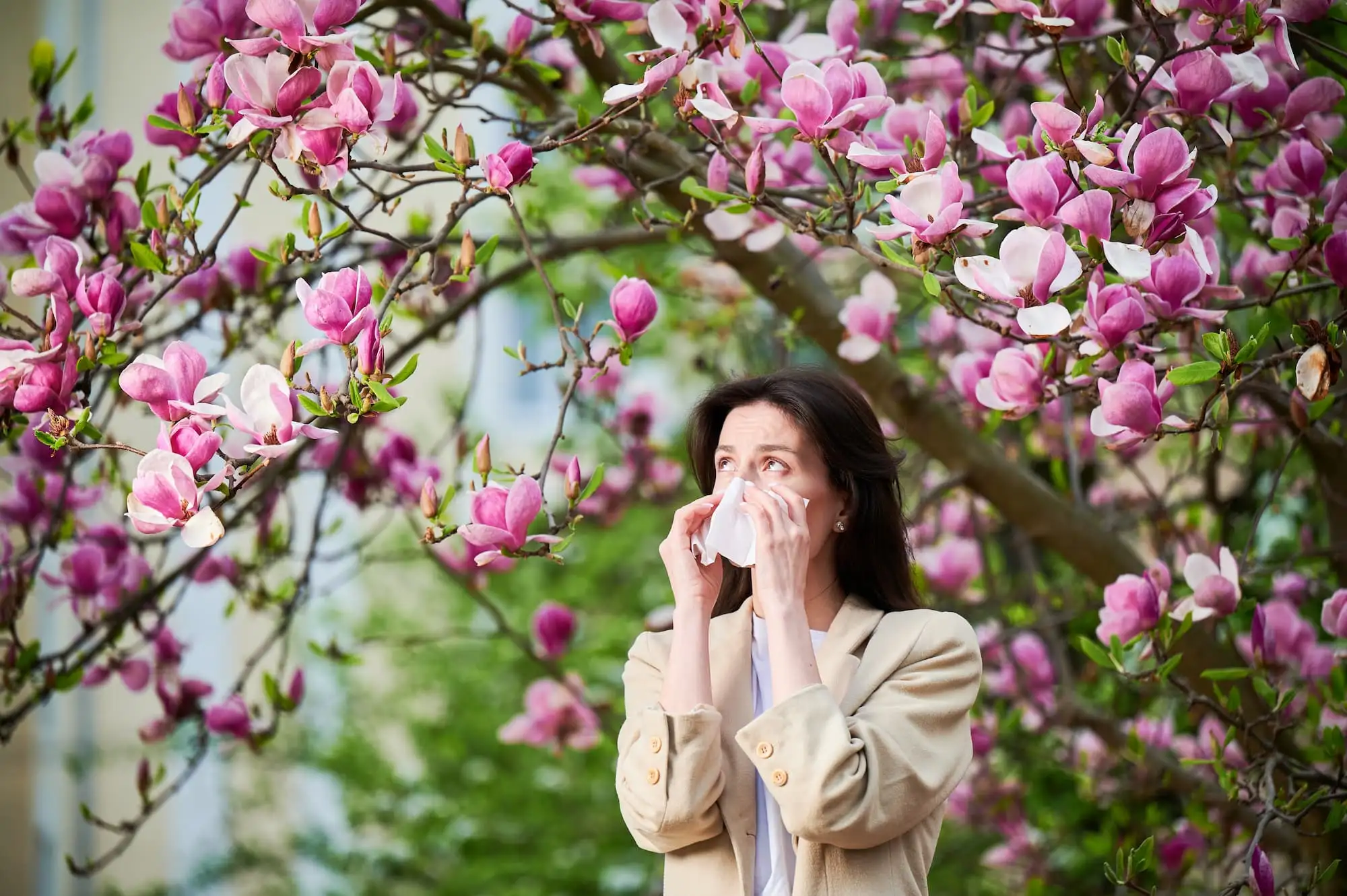 Seasonal allergic rhinitis
