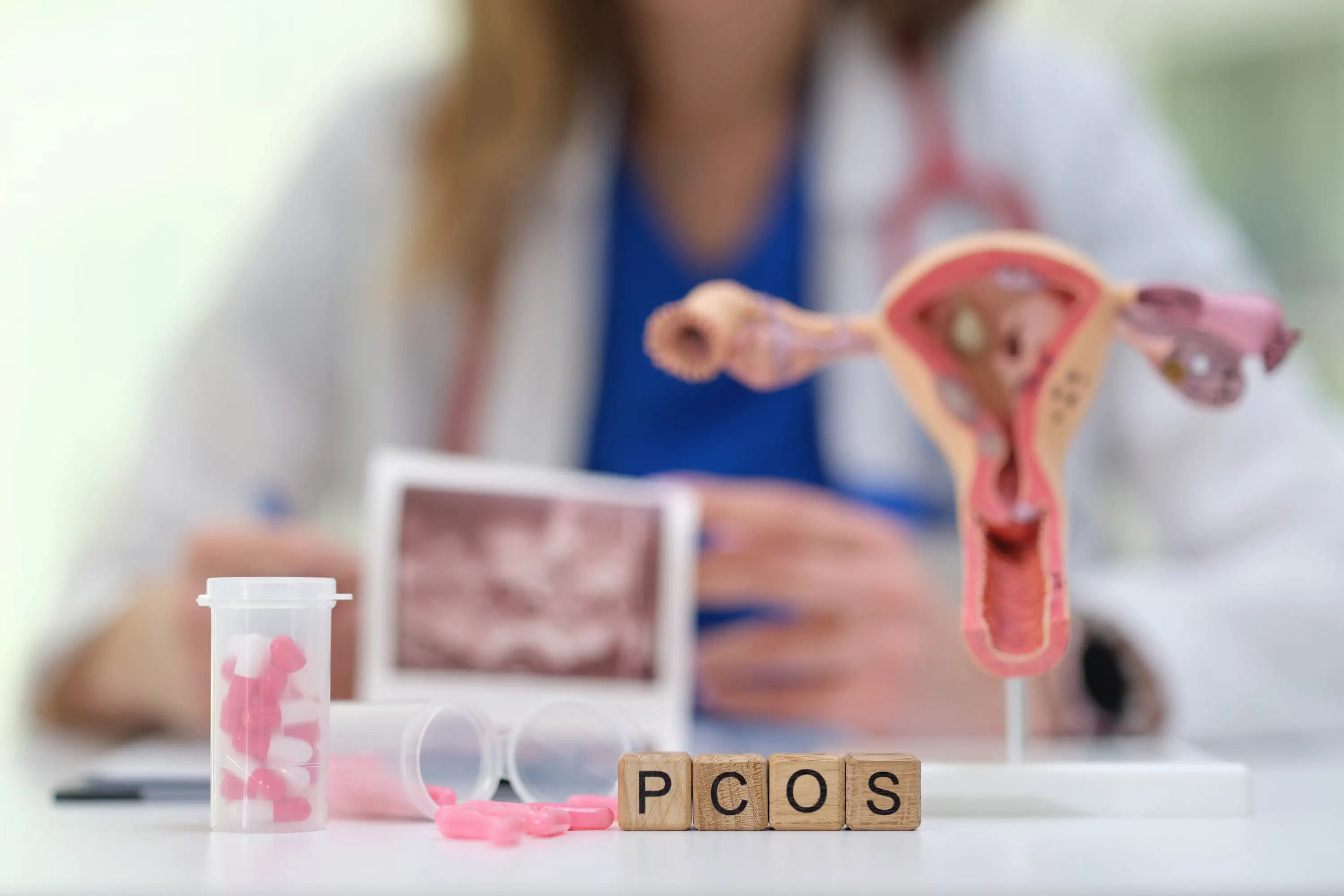 Polycystic ovary syndrome