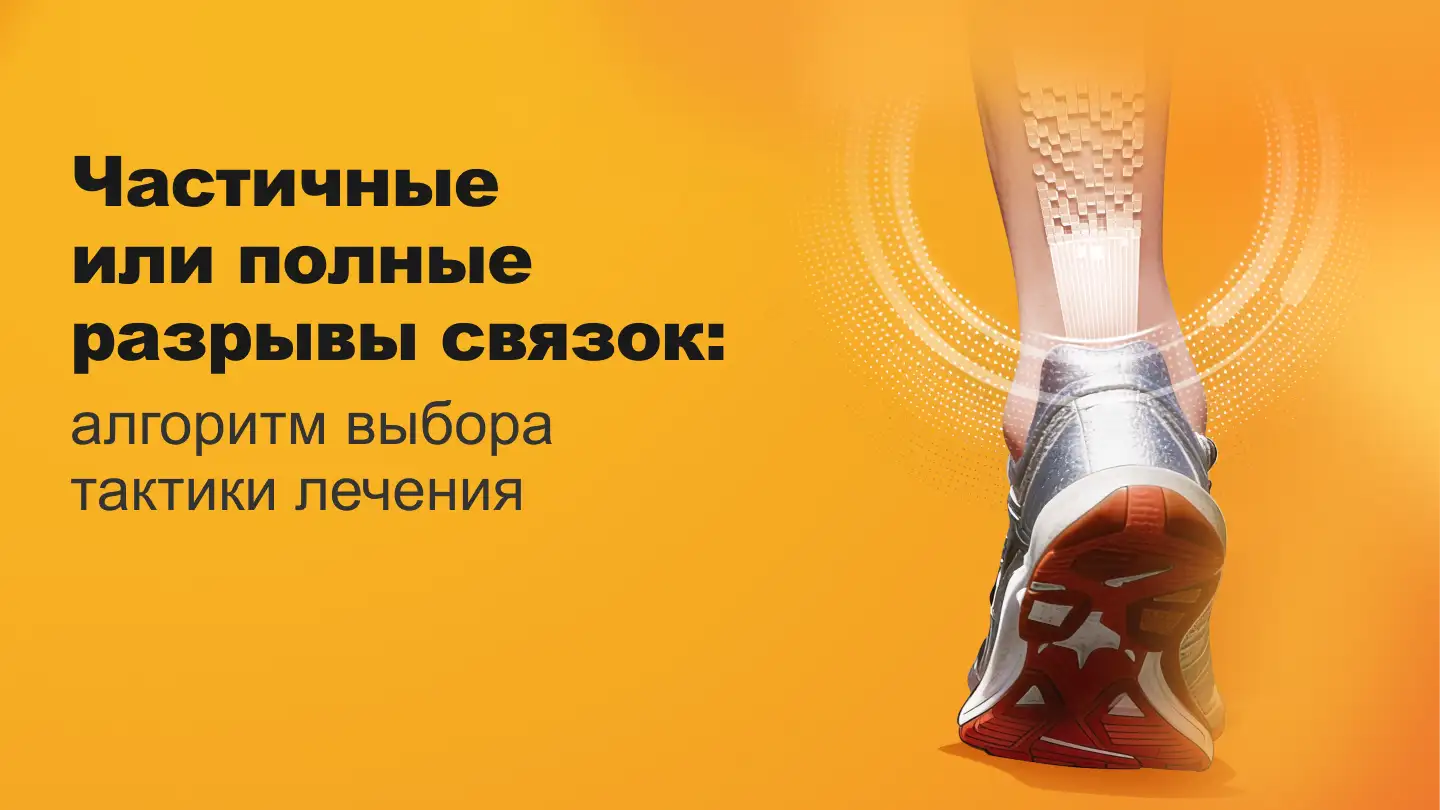 Частичные или полные разрывы связок, алгоритм выбора тактики лечения