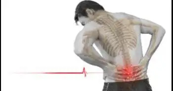 Боль в нижней части спины: особенности ведения пациентов