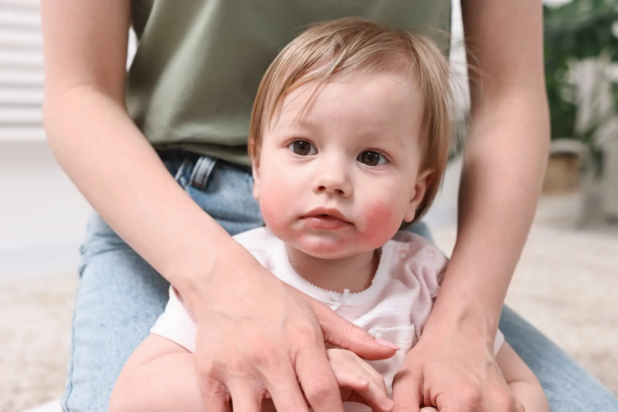 Childhood food allergy