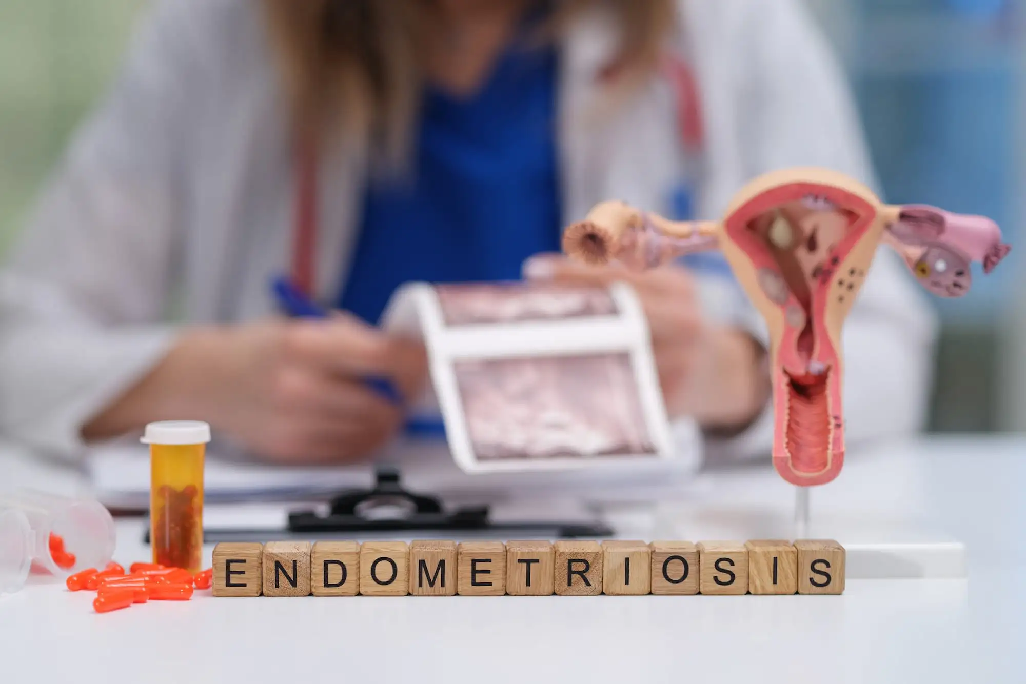 Endometriosis