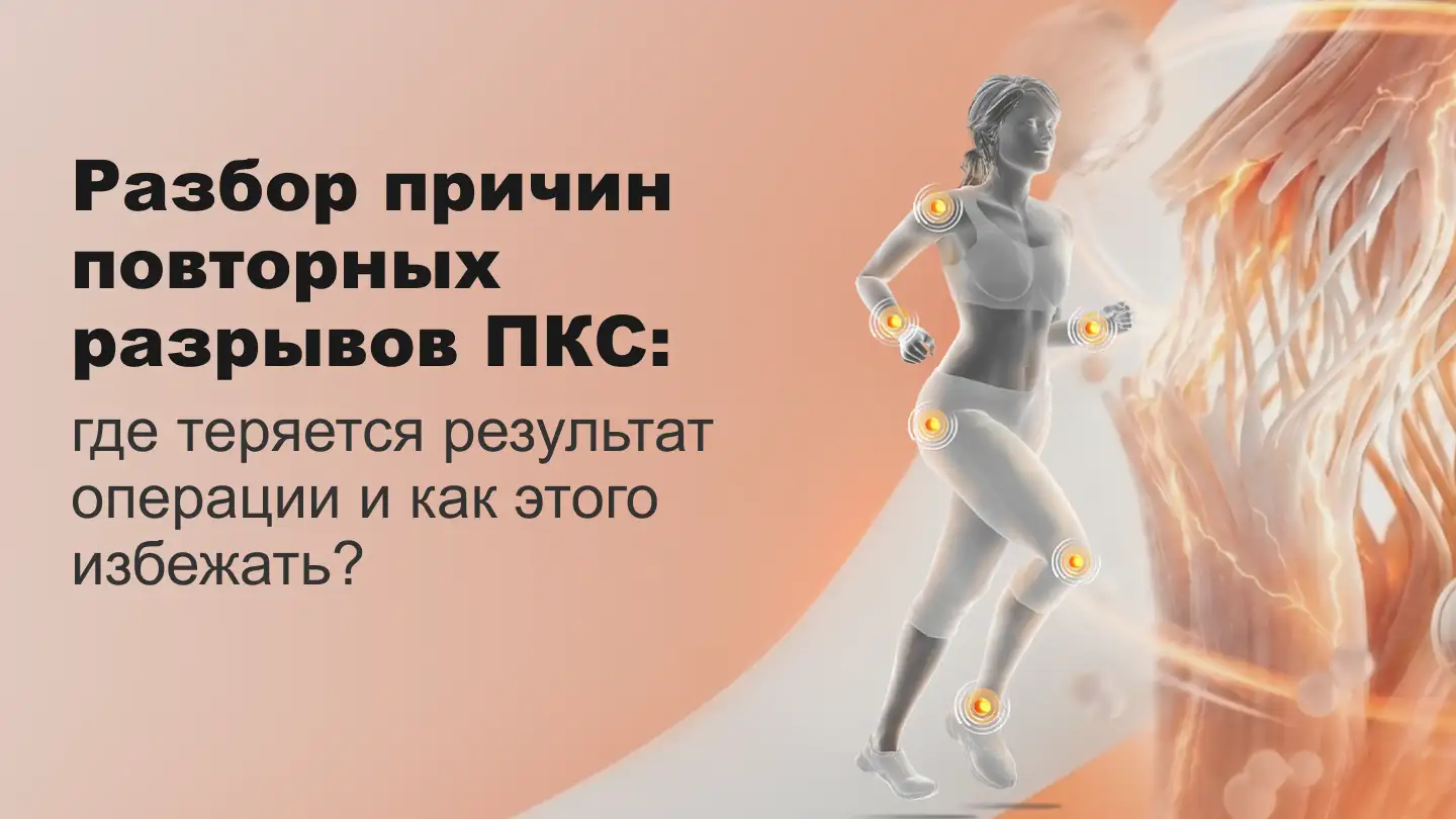 Пластика ПКС ошибки, которые могут привести к повторному разрыву