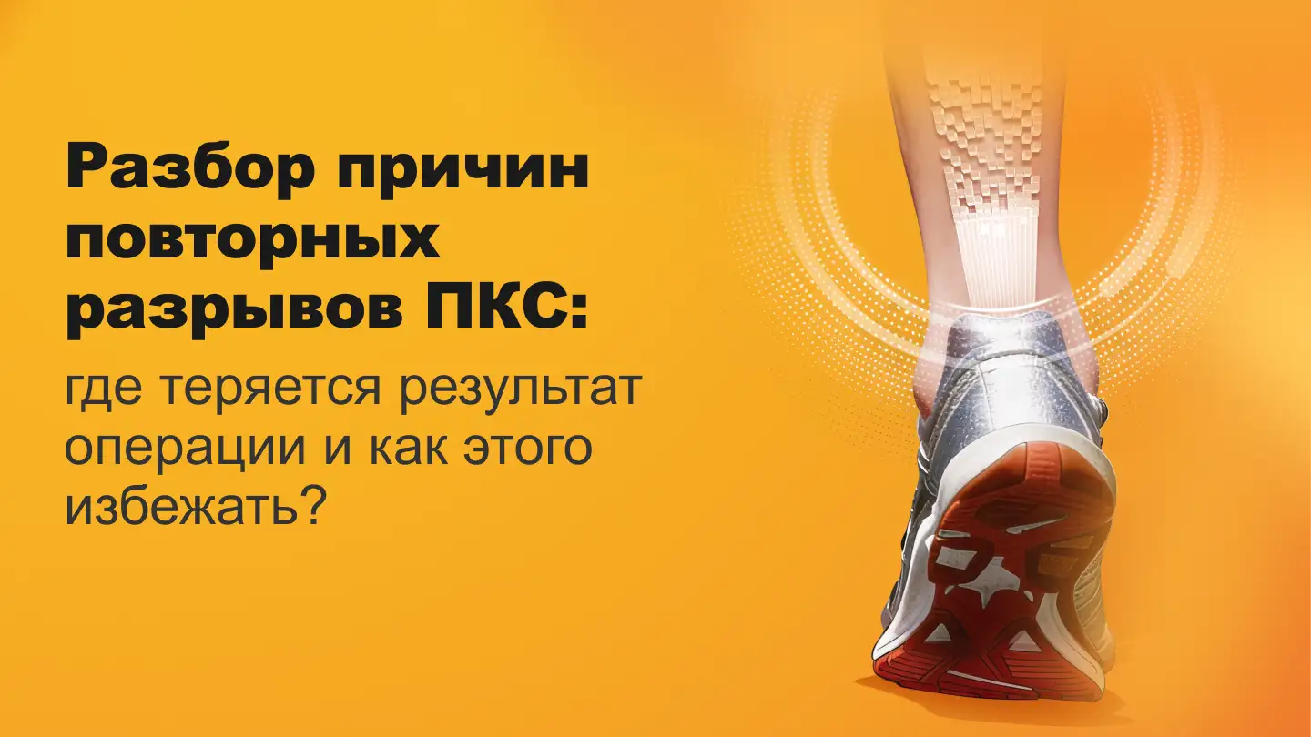 Пластика ПКС ошибки, которые могут привести к повторному разрыву