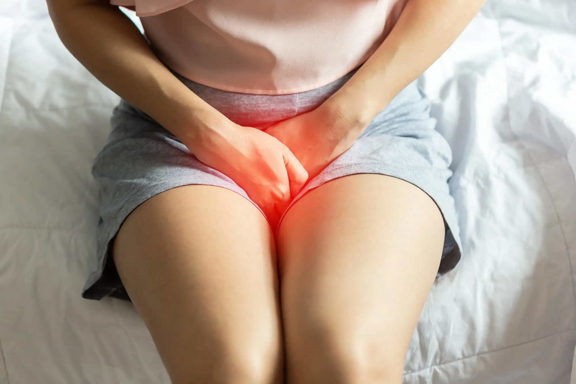Vulvovaginal candidiasis