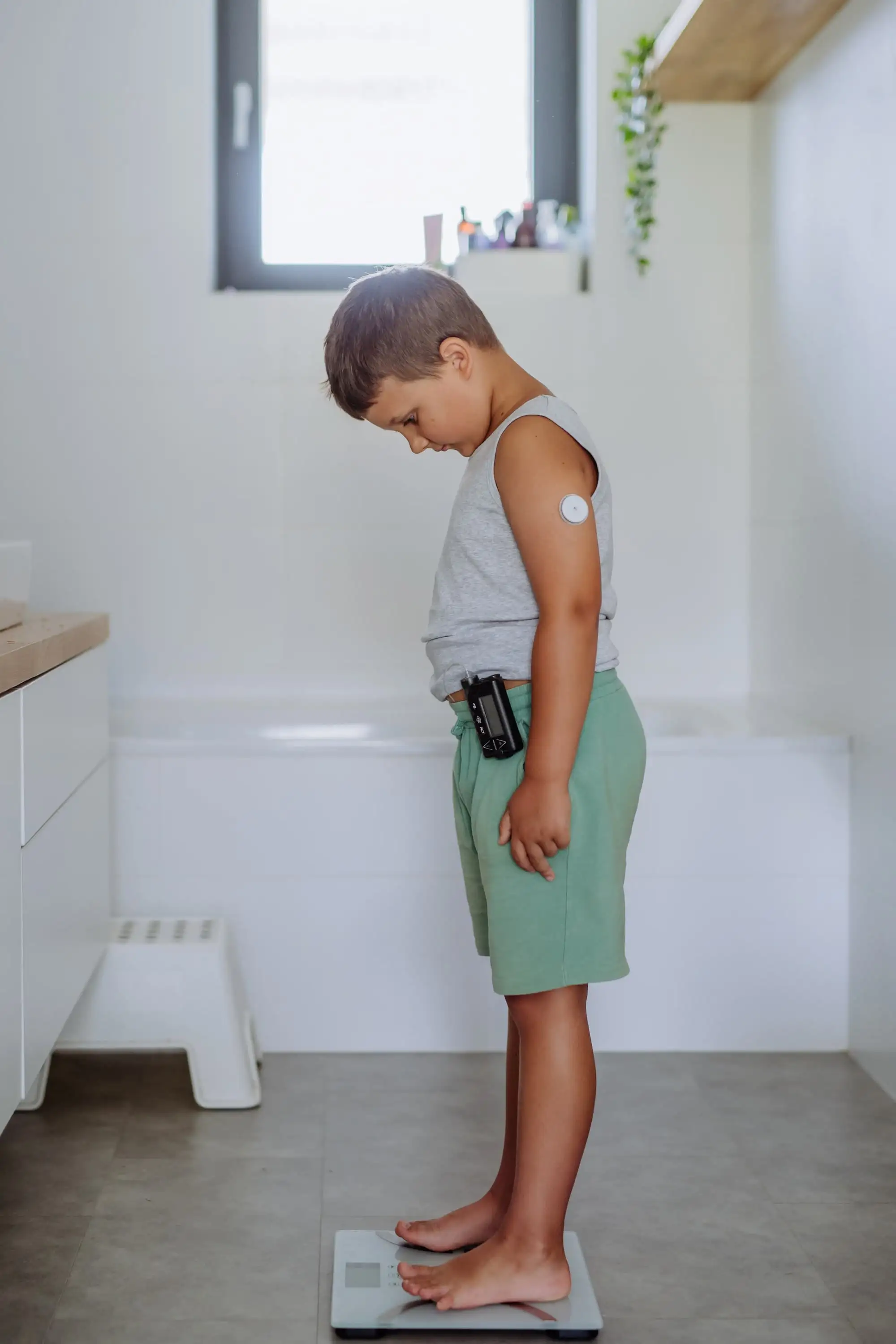 Type 1 diabetes mellitus and obesity in pediatric patients
