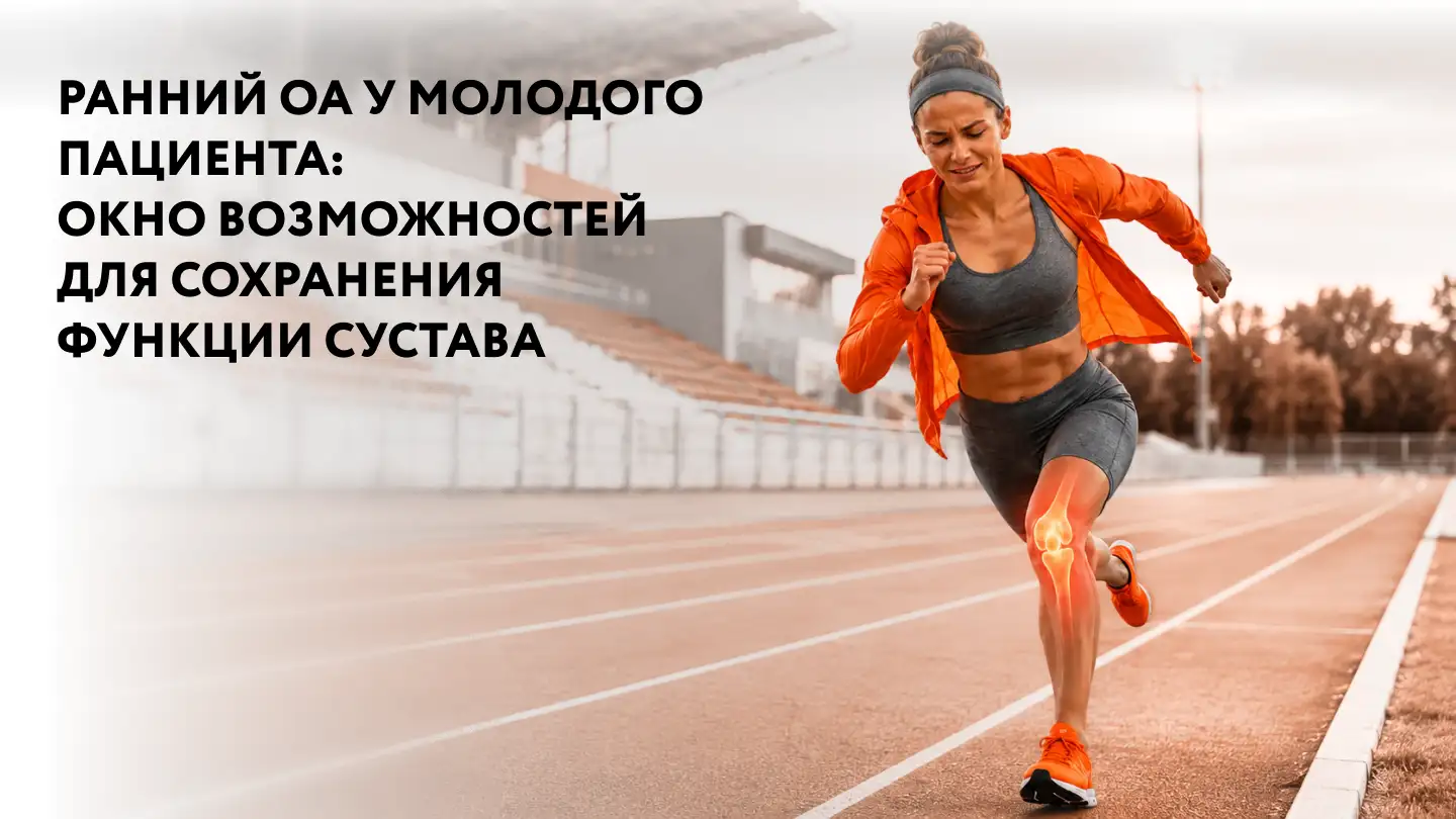 Ранний ОА у молодого пациента: окно возможностей для сохранения функции сустава