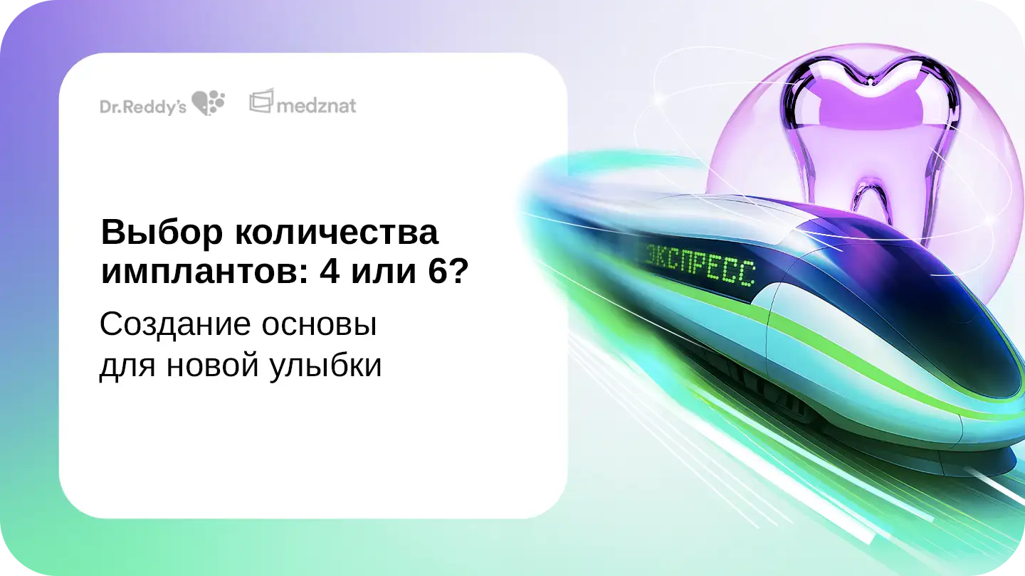 Выбор количества имплантов – 4 или 6: создание основы для новой улыбки