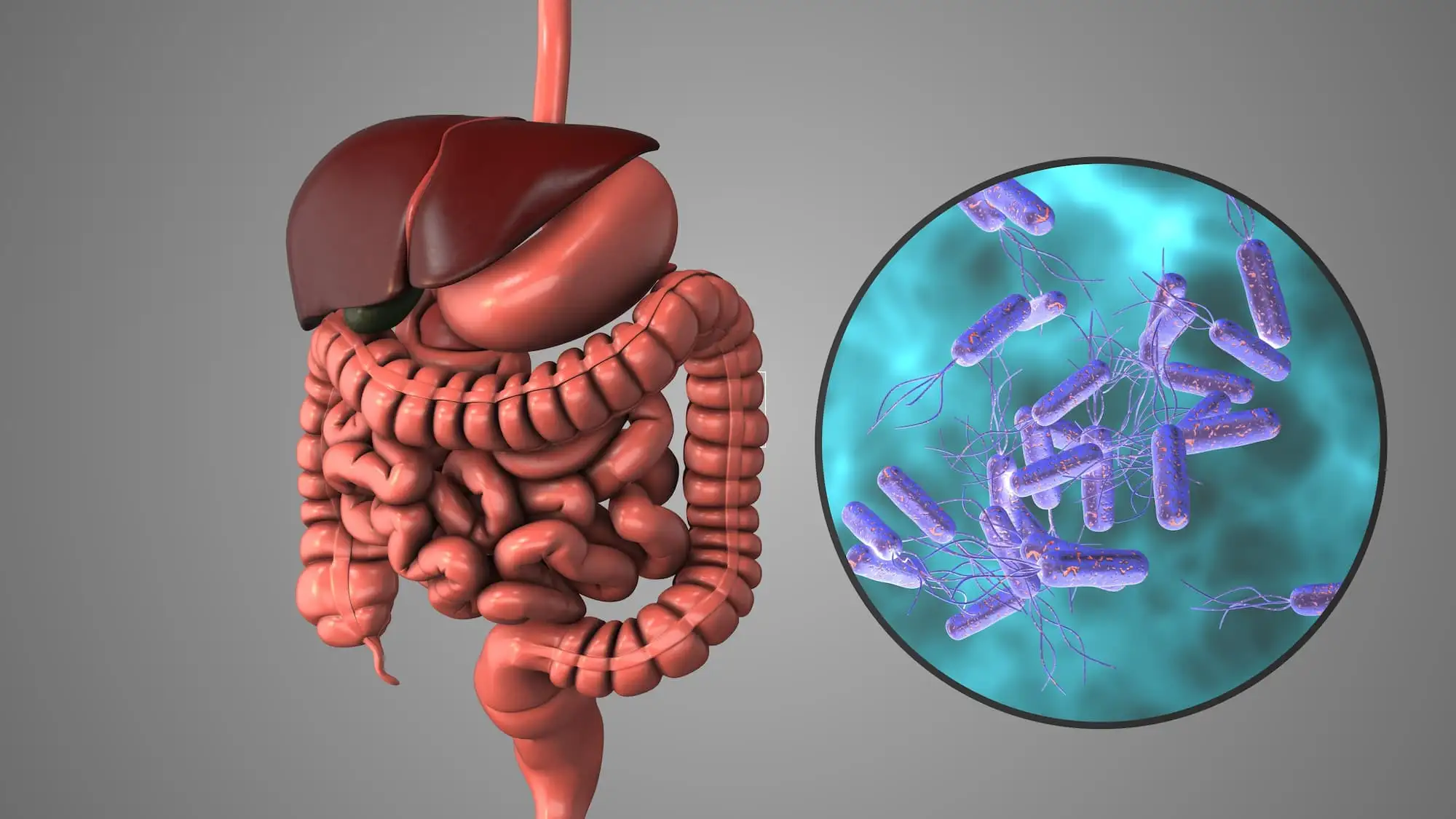 Helicobacter pylori infection
