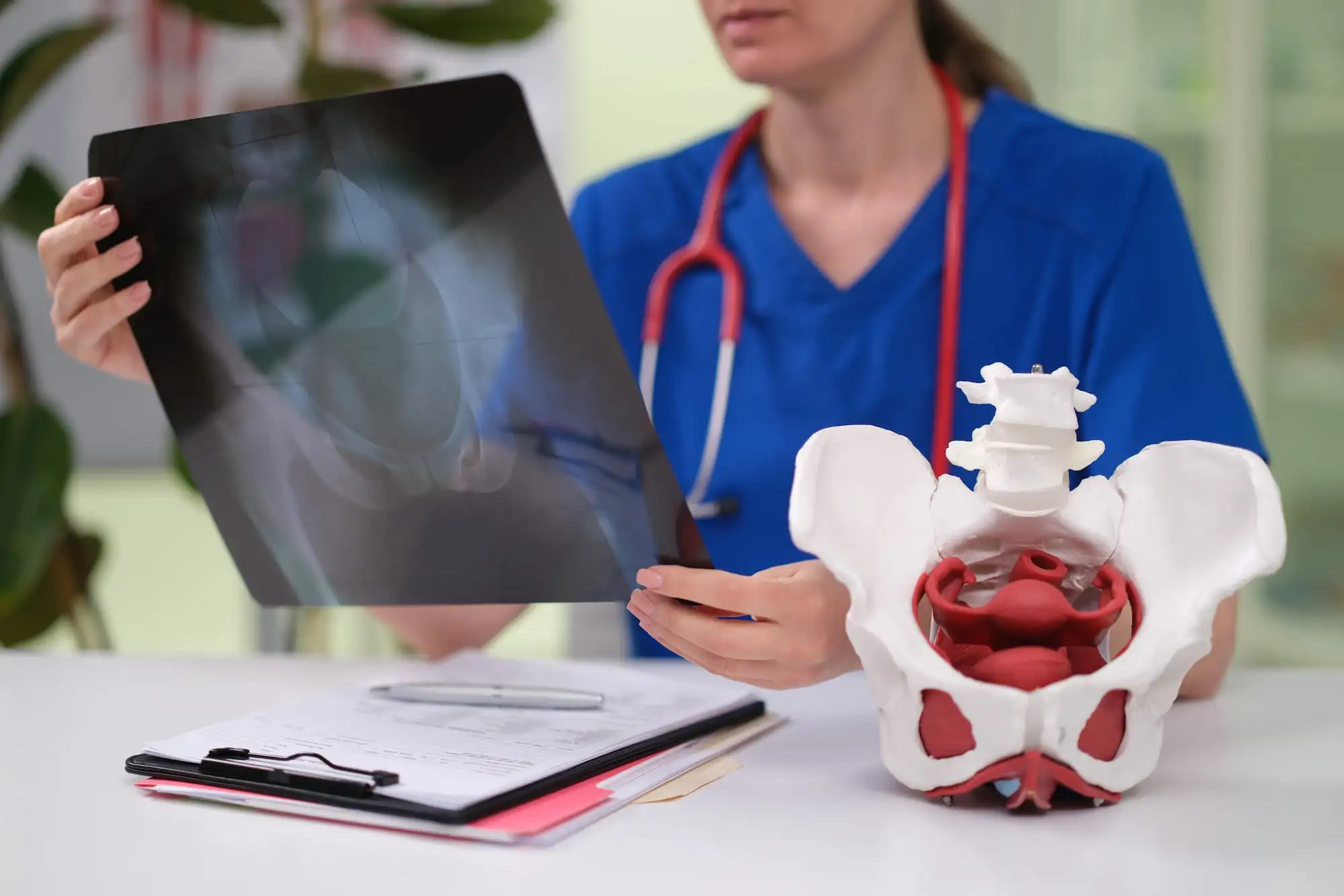 Hip fracture