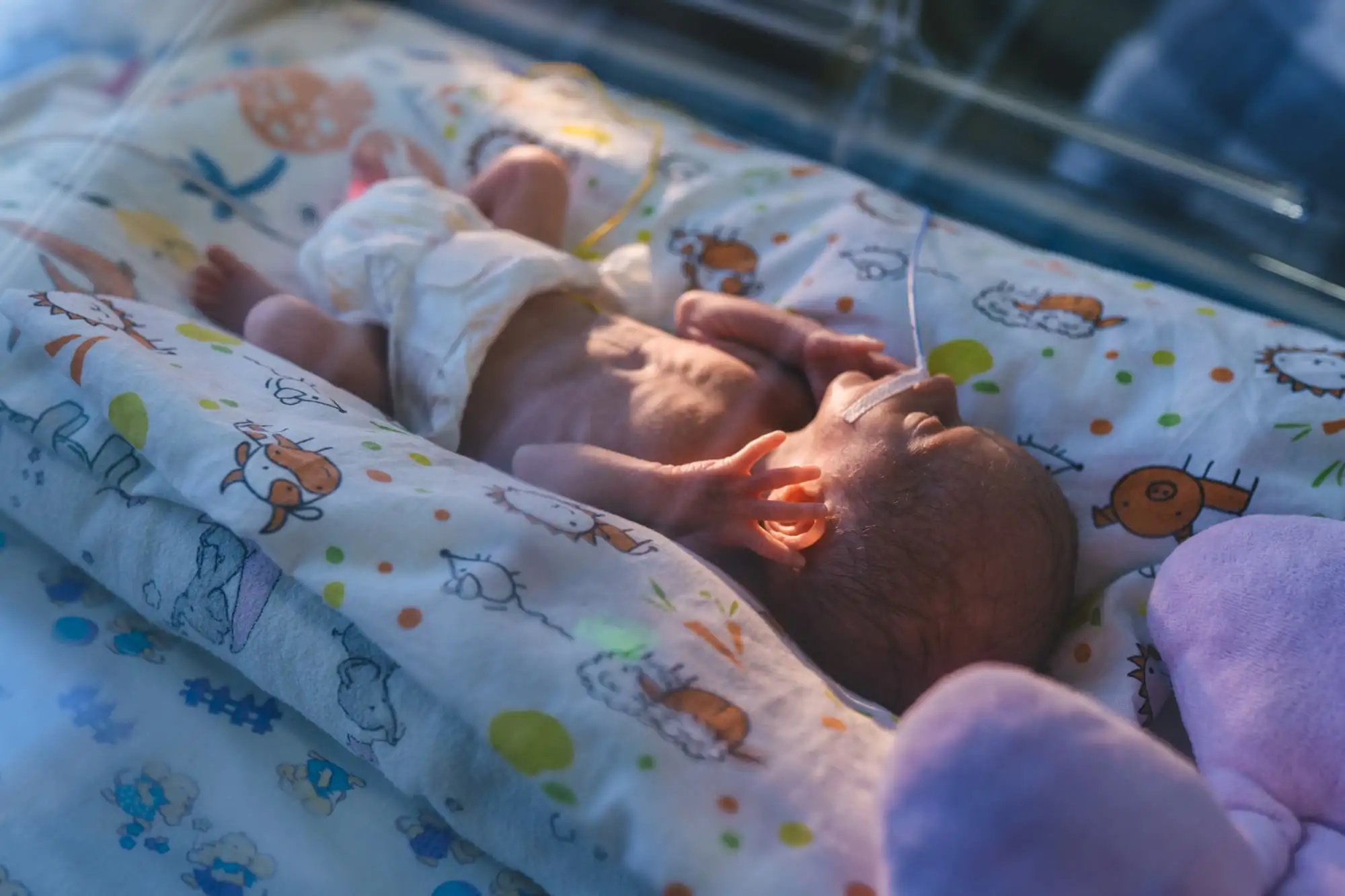 Extremely preterm infants