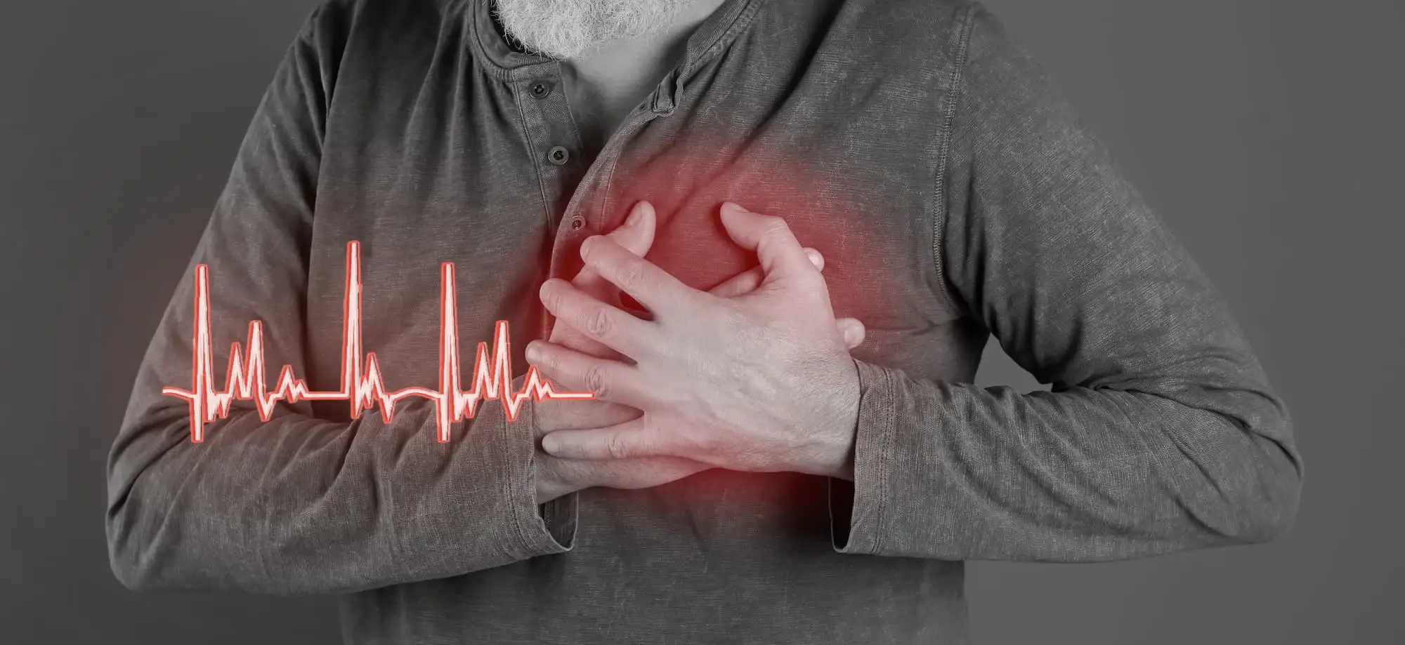 Atrial fibrillation