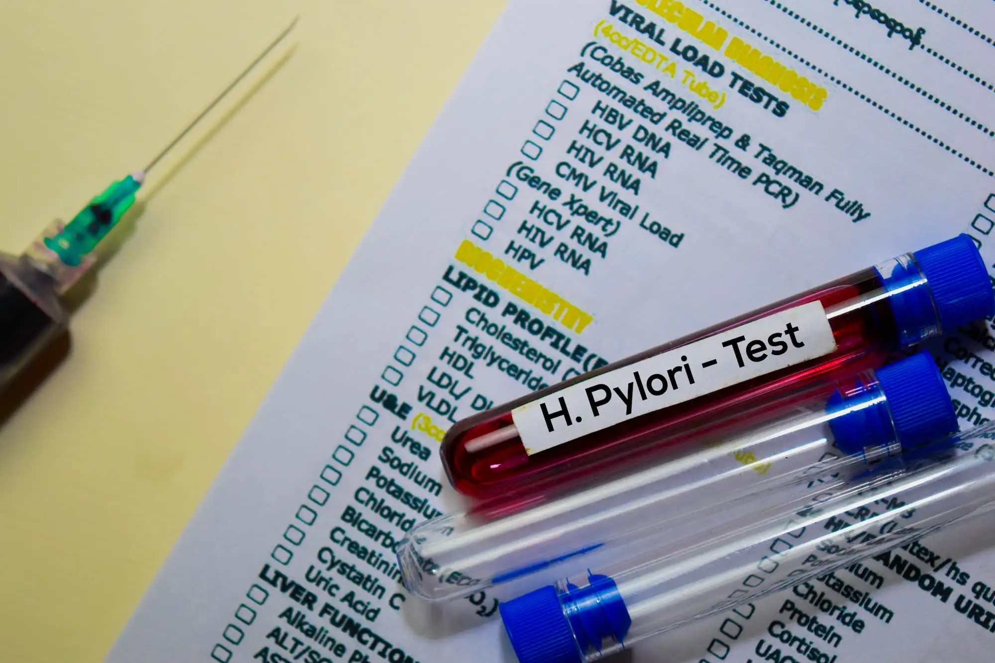 Helicobacter pylori  in children and adolescents