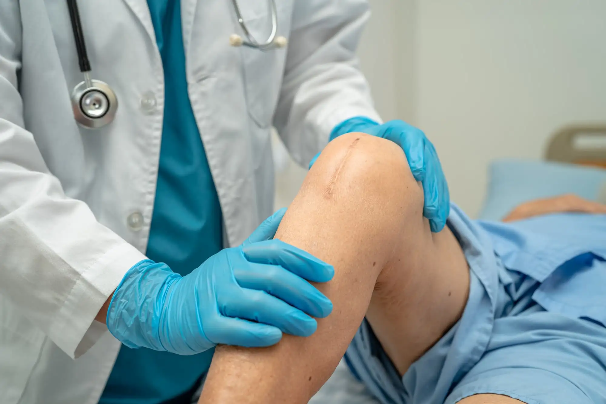 Total knee arthroplasty