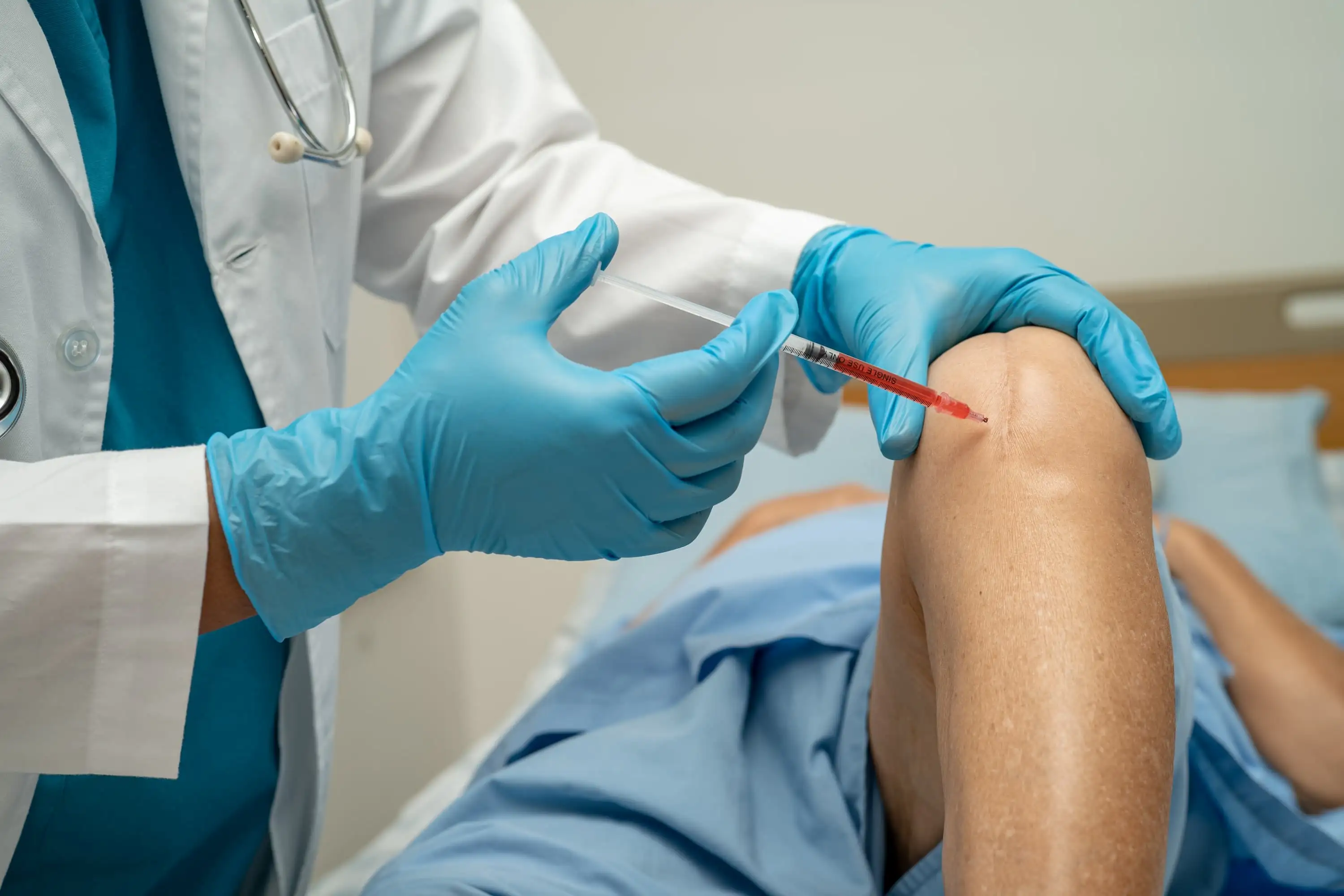 Knee osteoarthritis