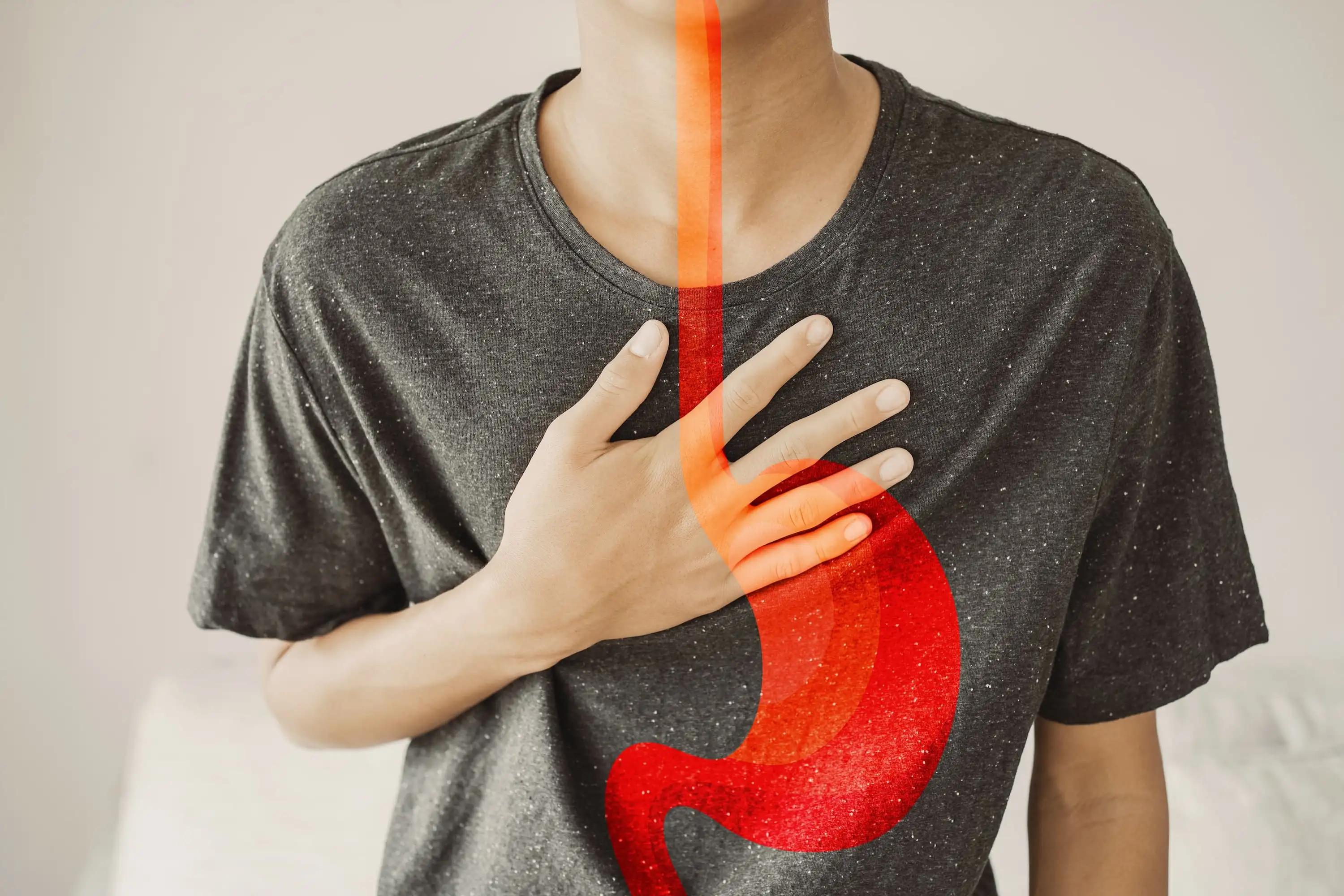 Esophagogastric junction outflow obstruction