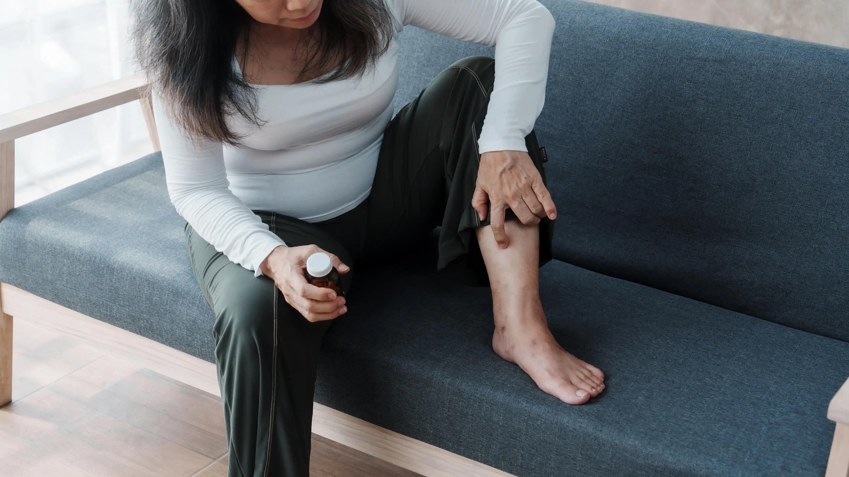 Inflammatory dermatoses